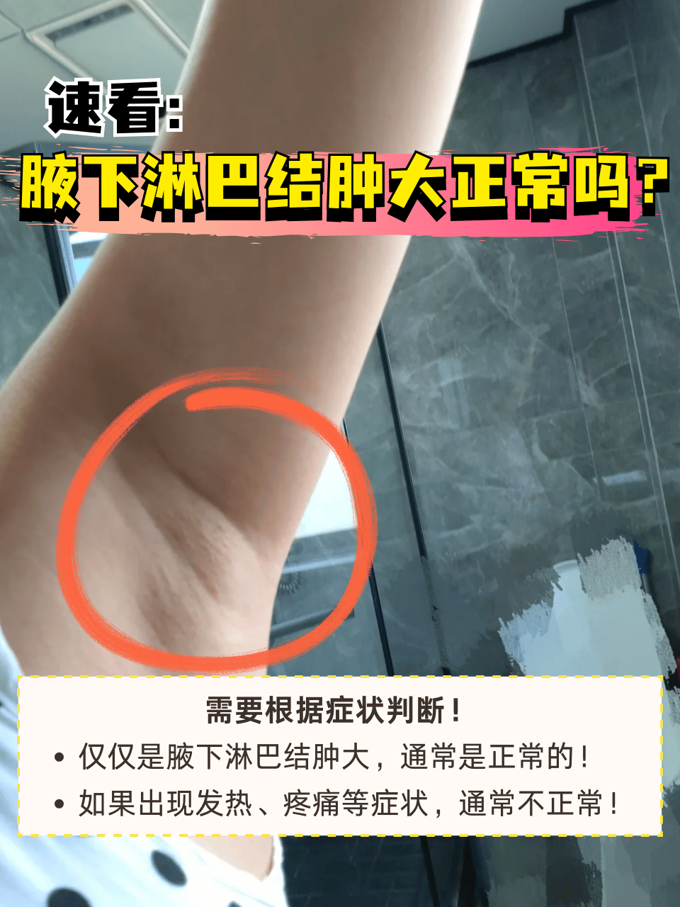 首先回答,腋下淋巴结肿大正不正常需要根据症状判断!仅
