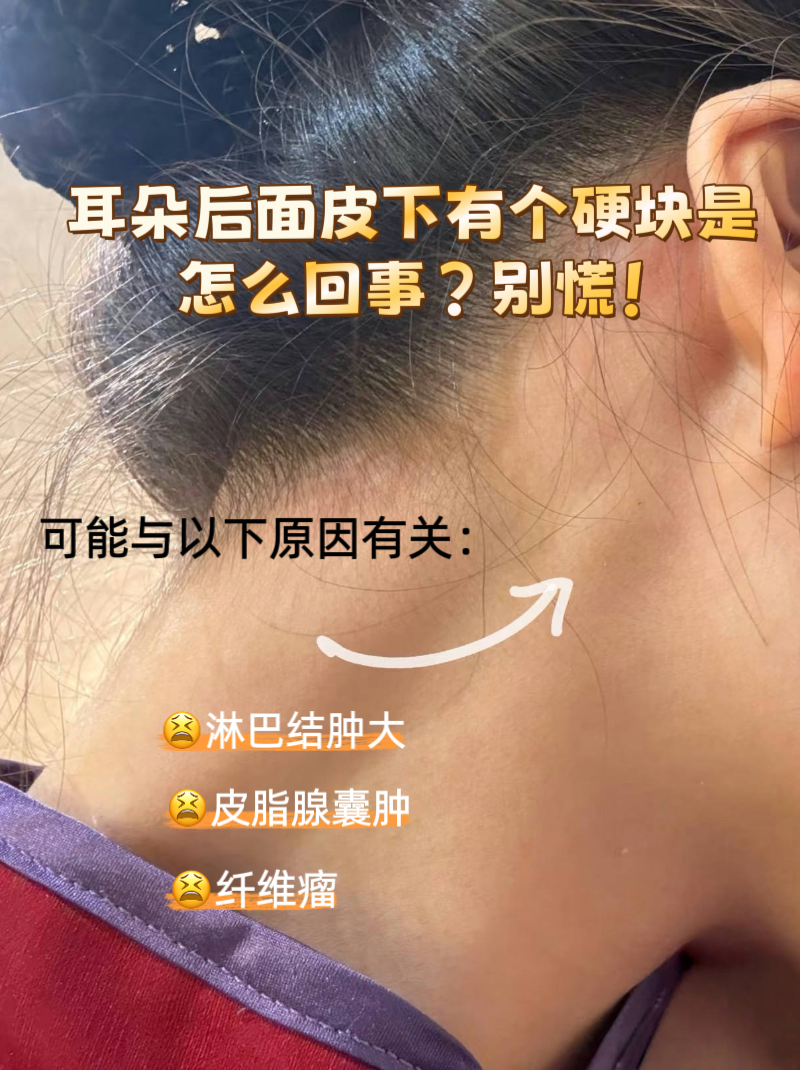别慌!  照镜子突然发现耳朵后面多了个"小硬块"?