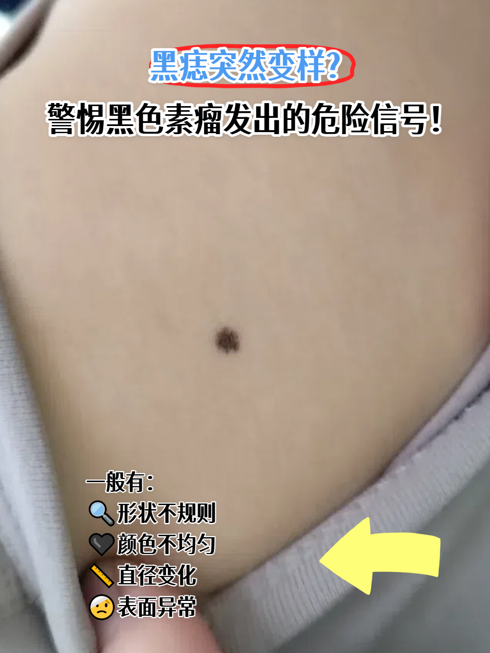 出现症状该如何应对?