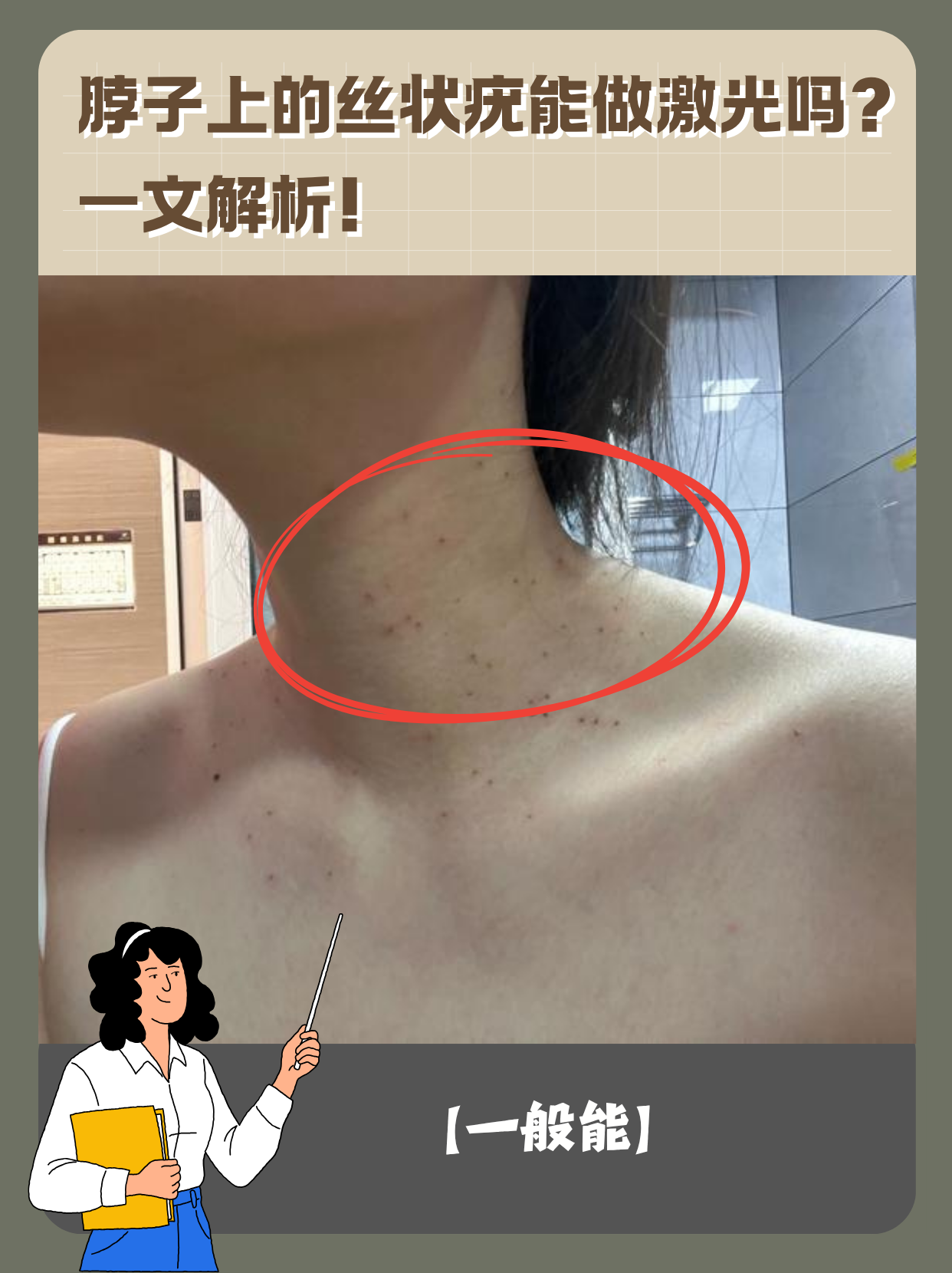 脖子上的丝状疣能做激光吗?一文解析!