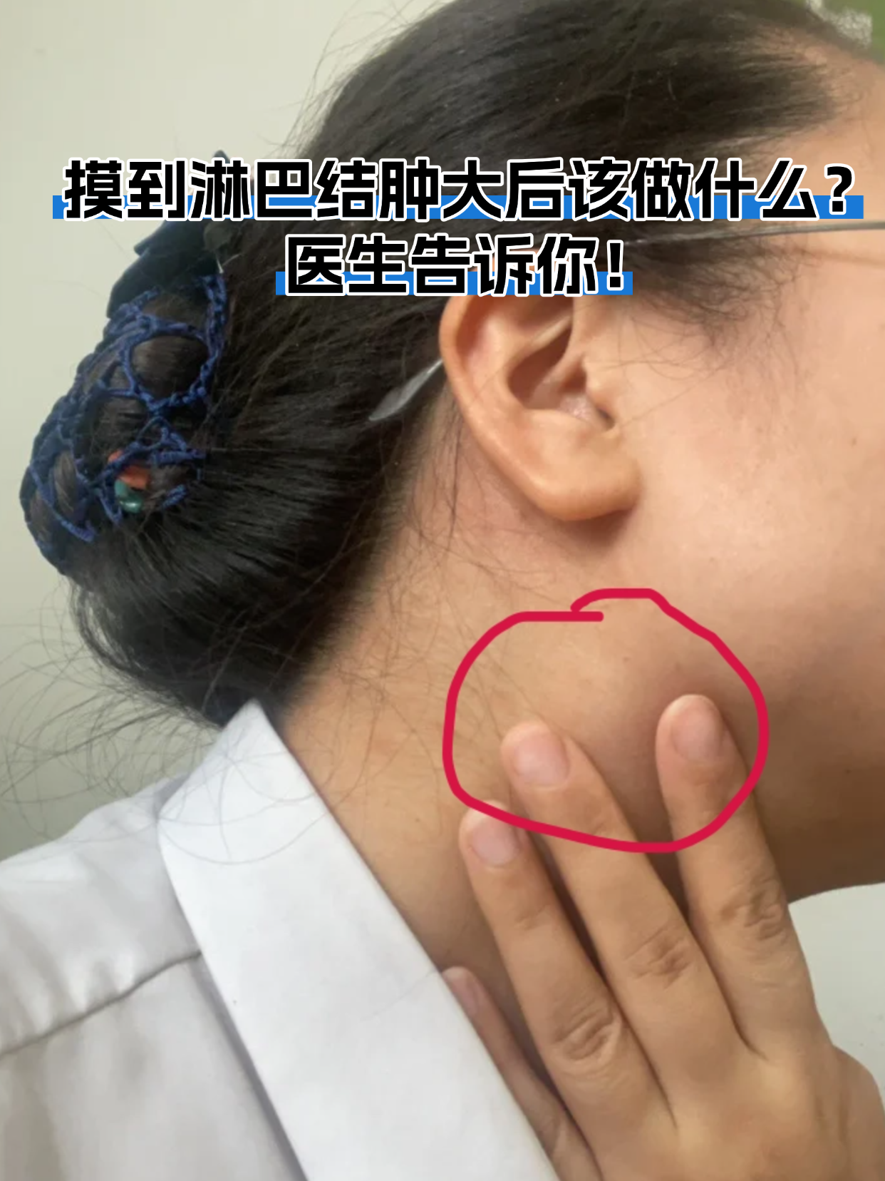 摸到淋巴结肿大后该做什么?医生告诉你!