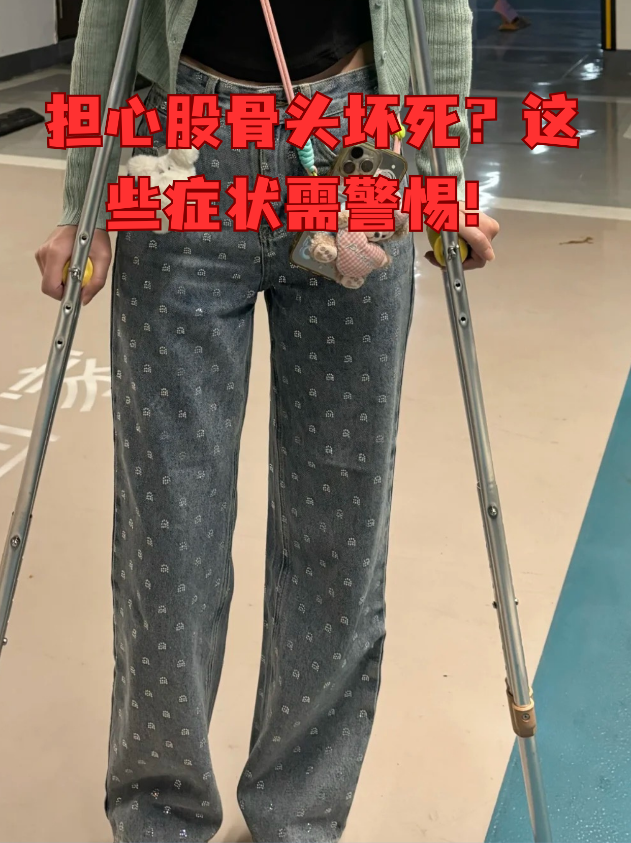 股骨头坏死早期可能只是髋部隐隐作痛,但随着病情发展会逐渐影响