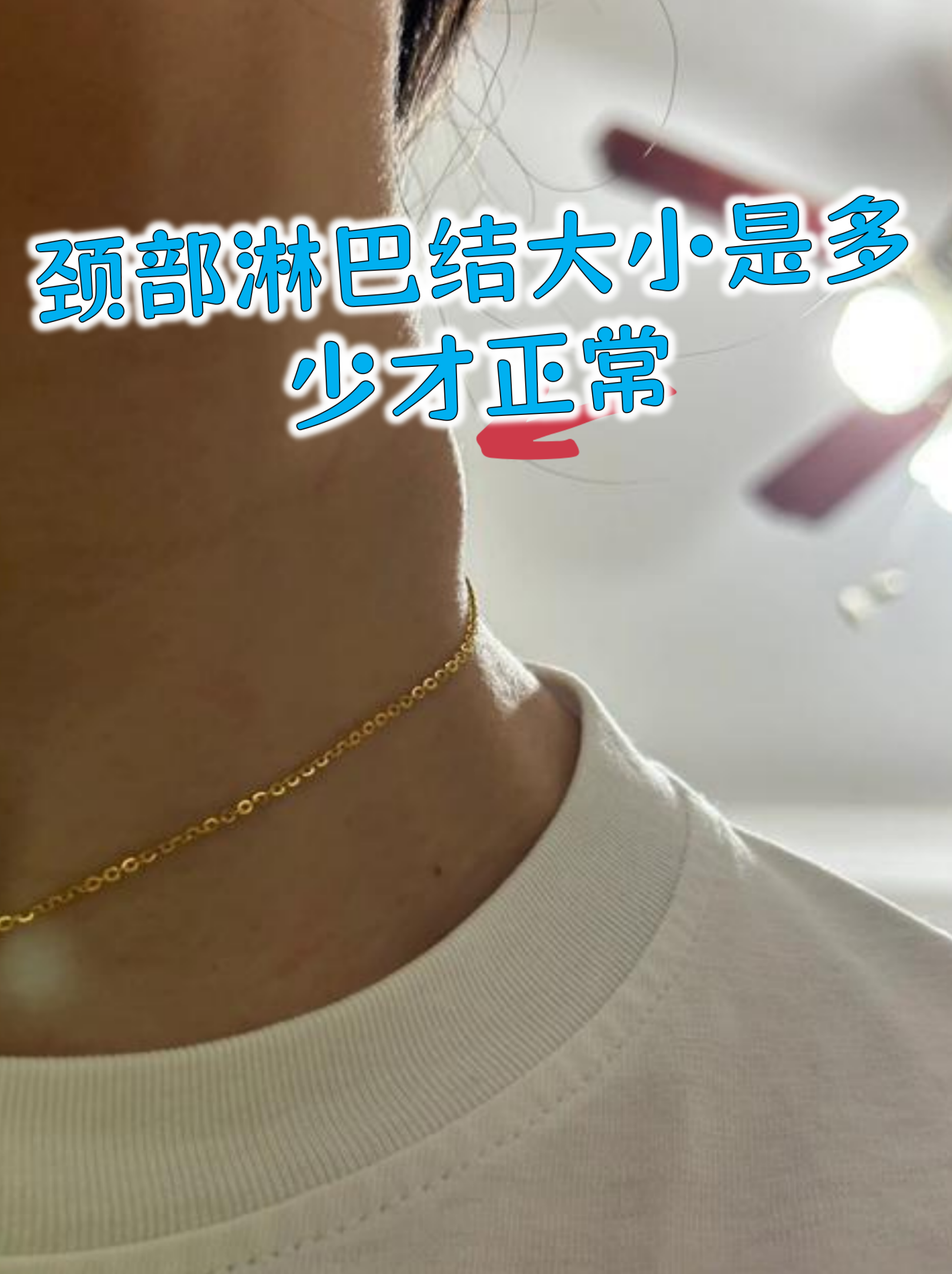 颈部淋巴结大小是多少才正常