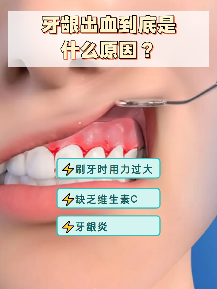 为什么牙龈出血