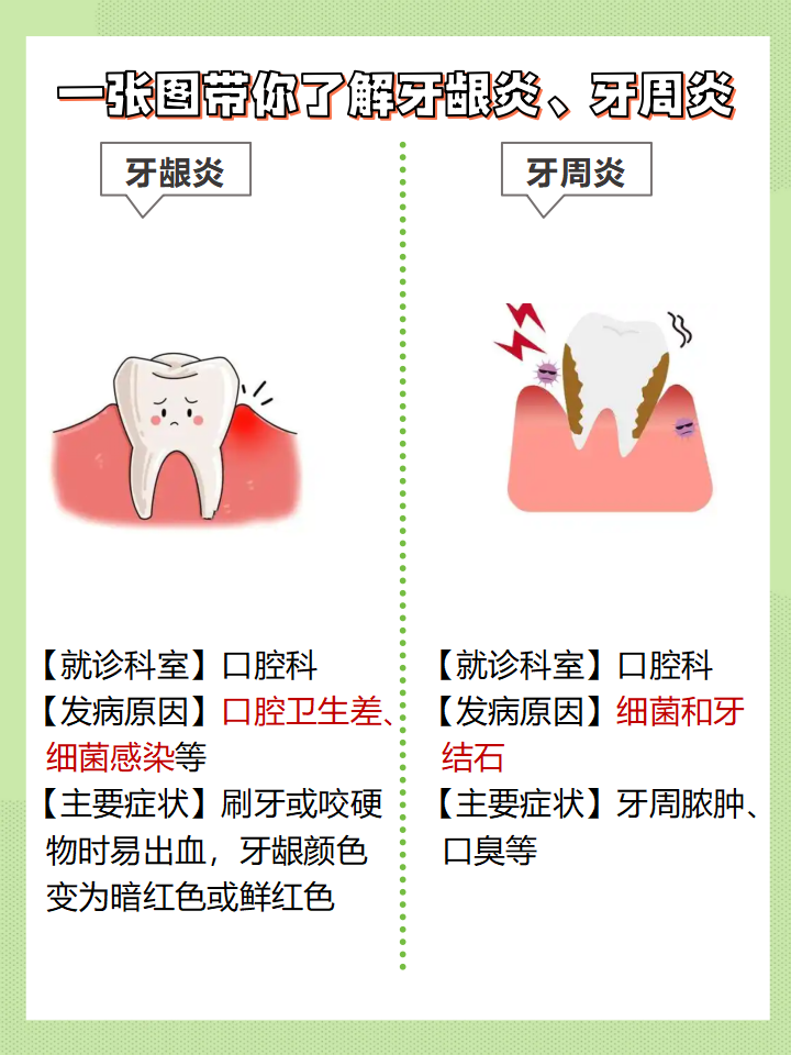 什么人容易得牙周炎百科在线