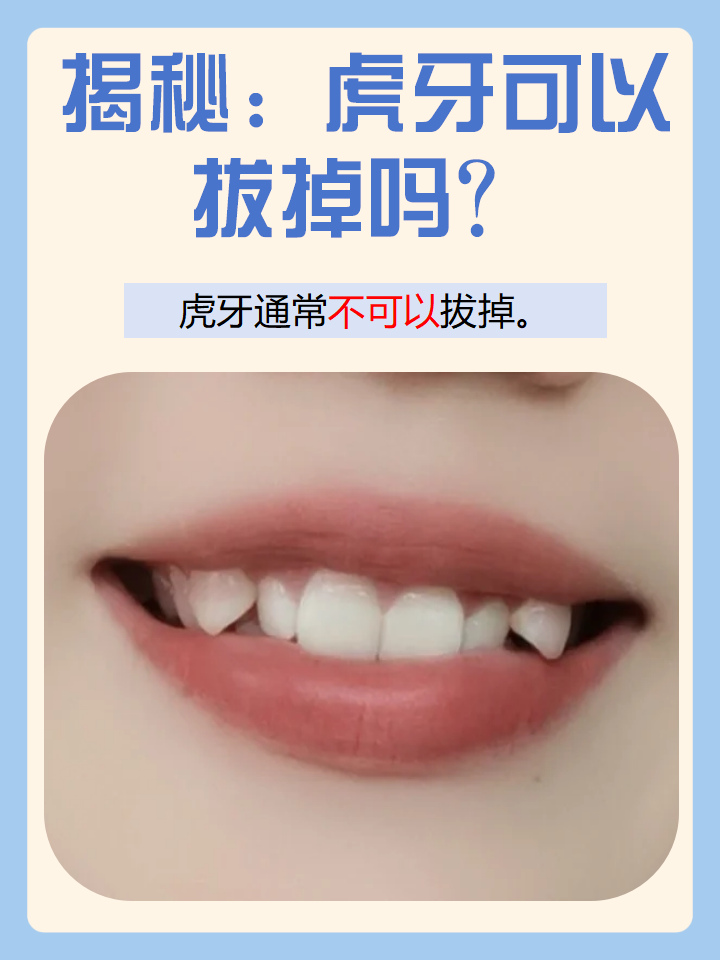 在口腔这个小小的世界里,虎牙是一种很特别的存在