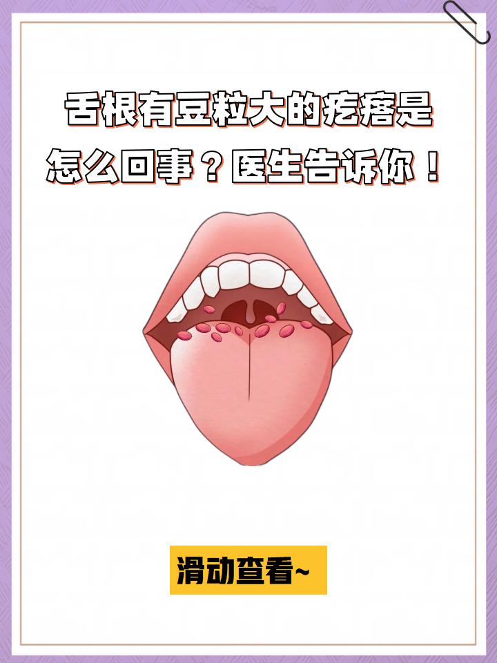 舌根部囊肿 为了有效缓解舌根疙瘩的舌头根部有疙瘩图片正常人舌根有