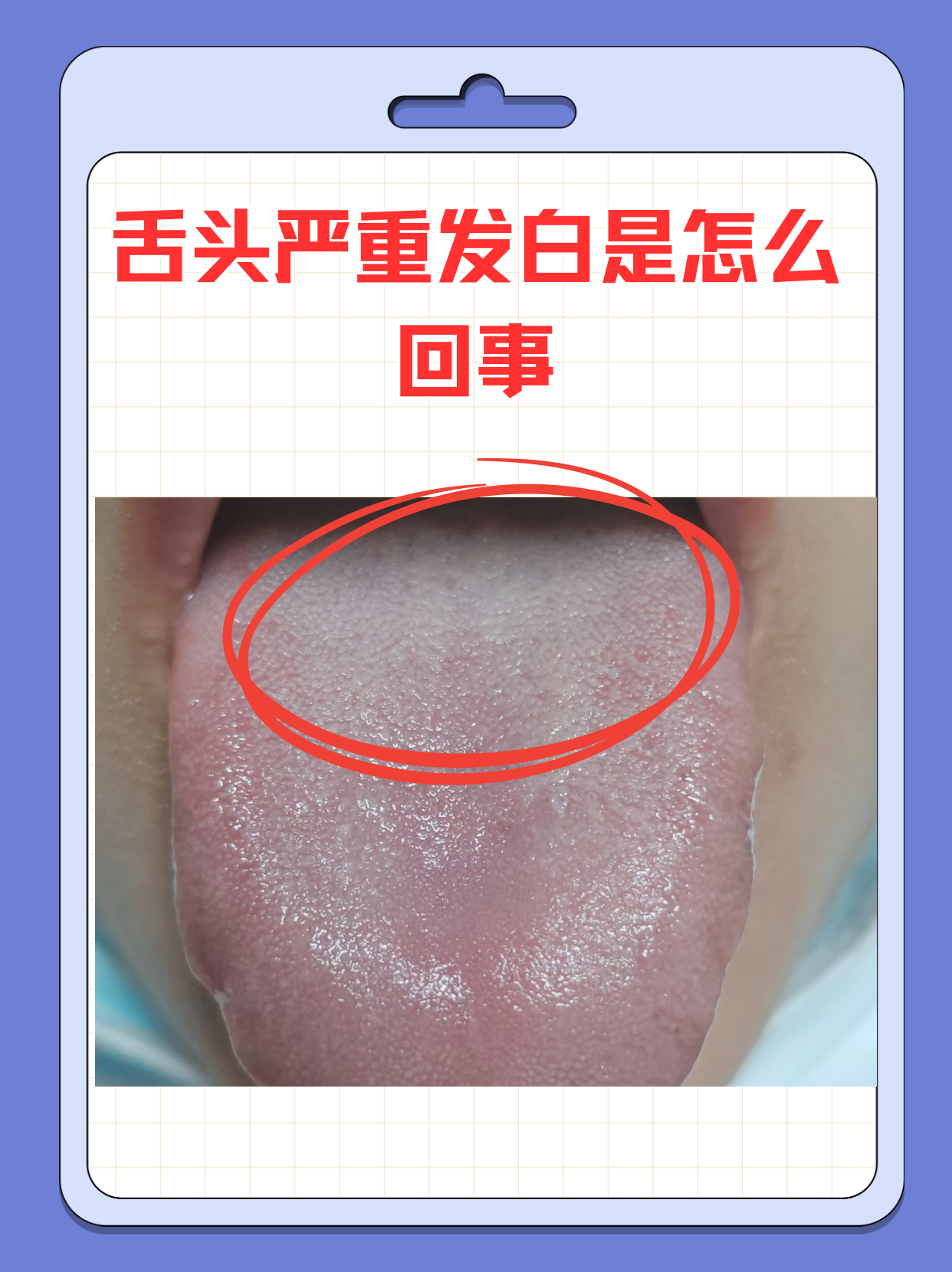 为什么舌头白