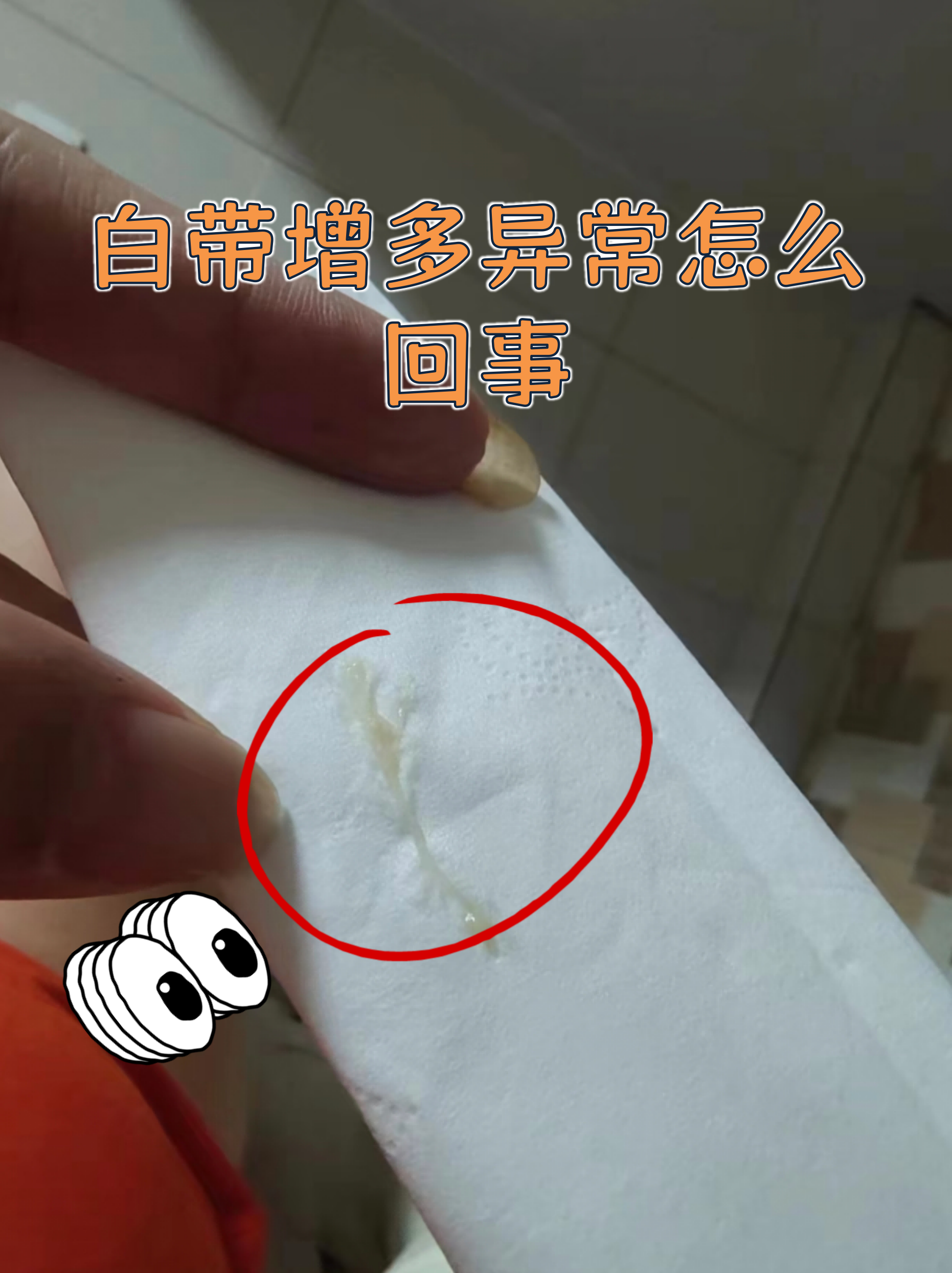 白带增多异常怎么回事