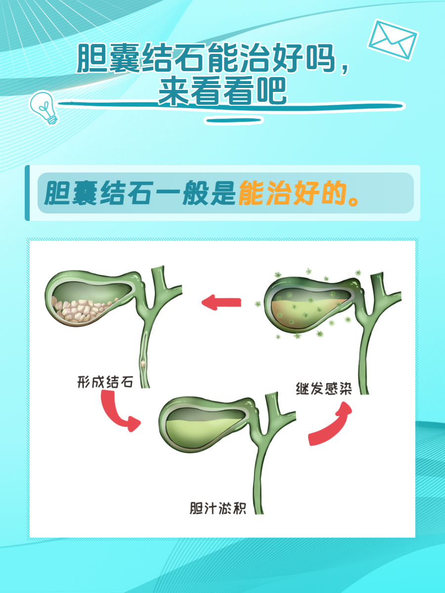 胆囊结石能治好吗,来看看吧 健康常常是我们最容易忽视却又最宝贵的
