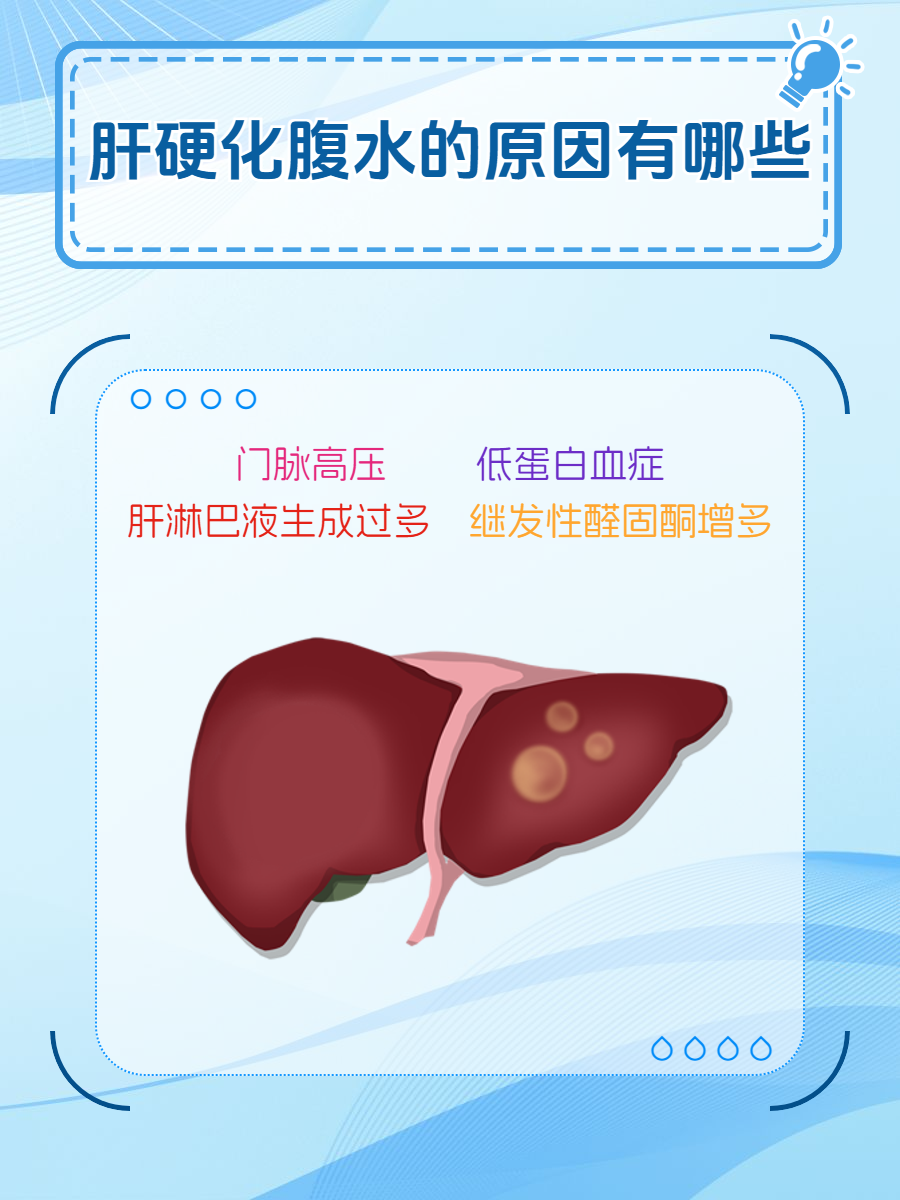 肝硬化腹水卡通图片