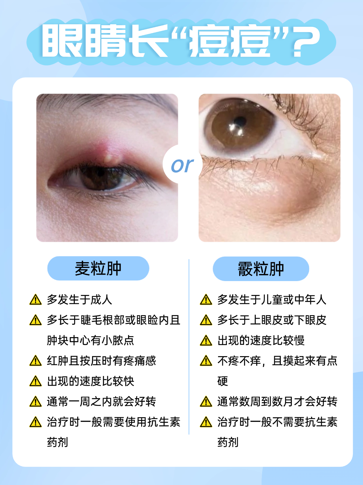 眼睛内侧长红疙瘩图片图片