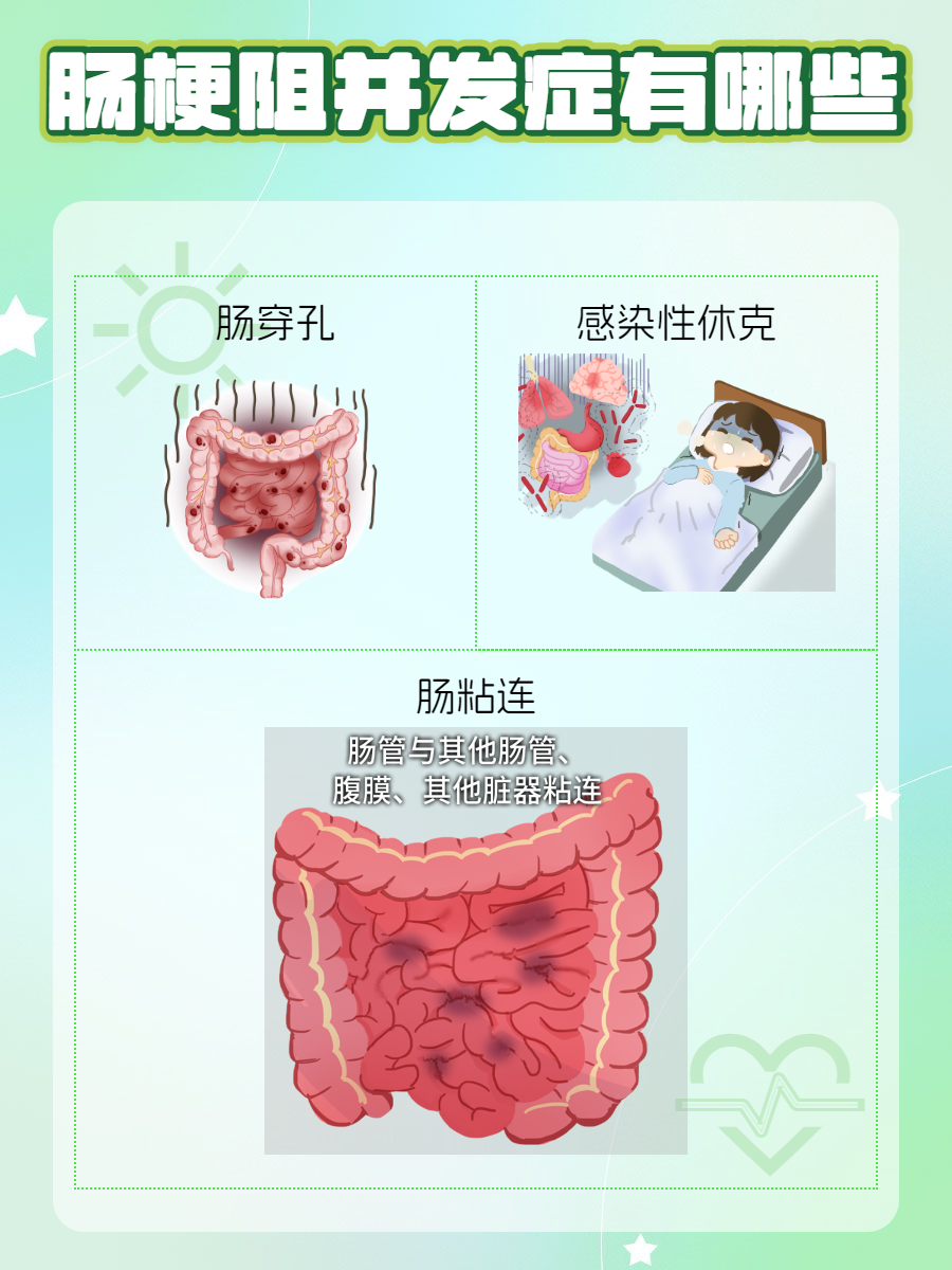 肠梗阻的10种表现