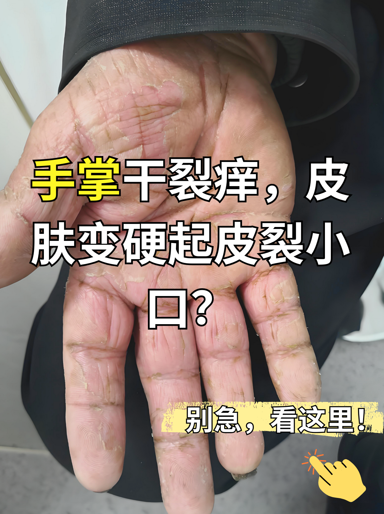 为什么手突然很痒 为什么手突然很痒