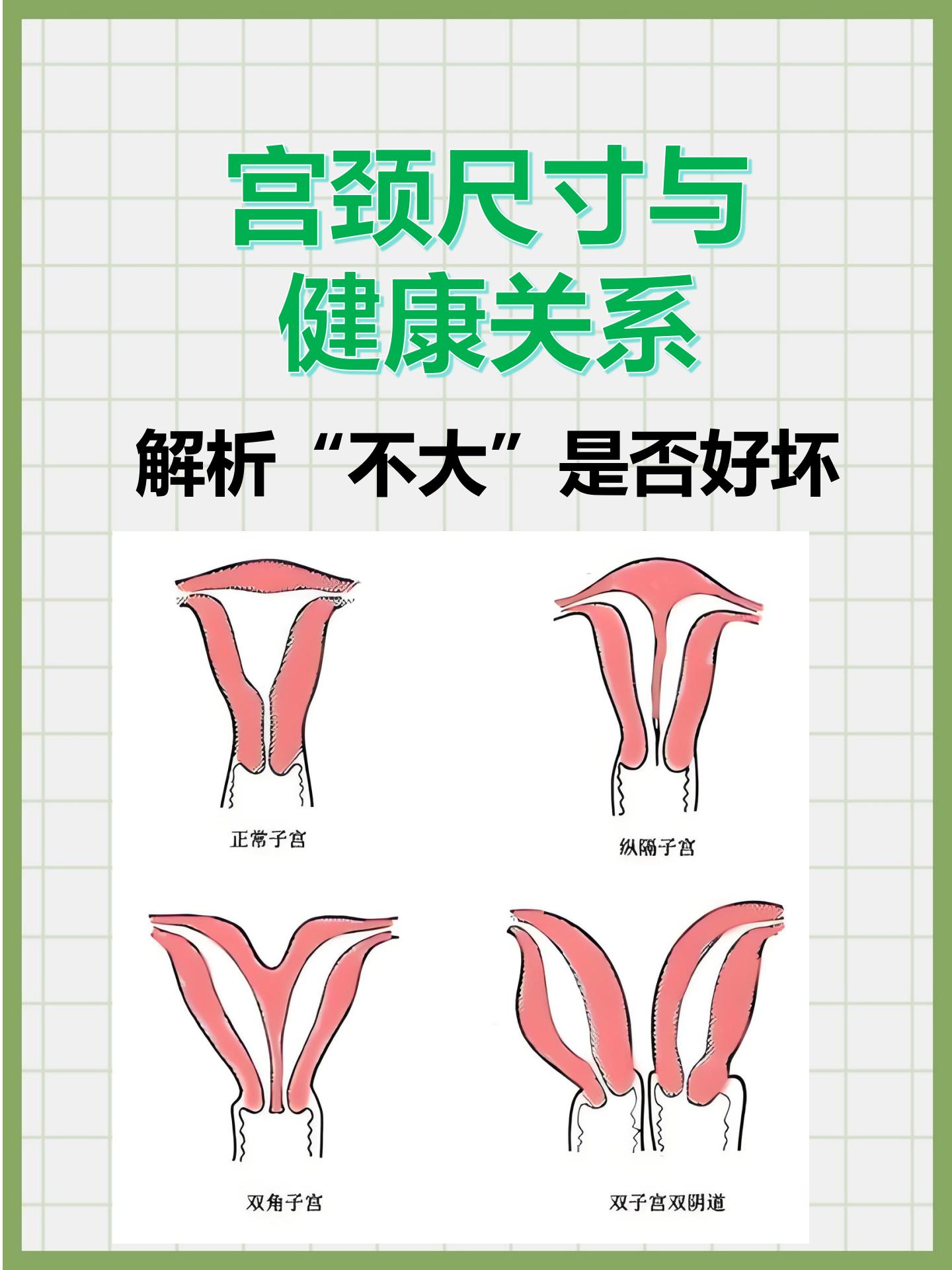在女性健康的世界里,宫颈健康常常是人们关注的焦点.
