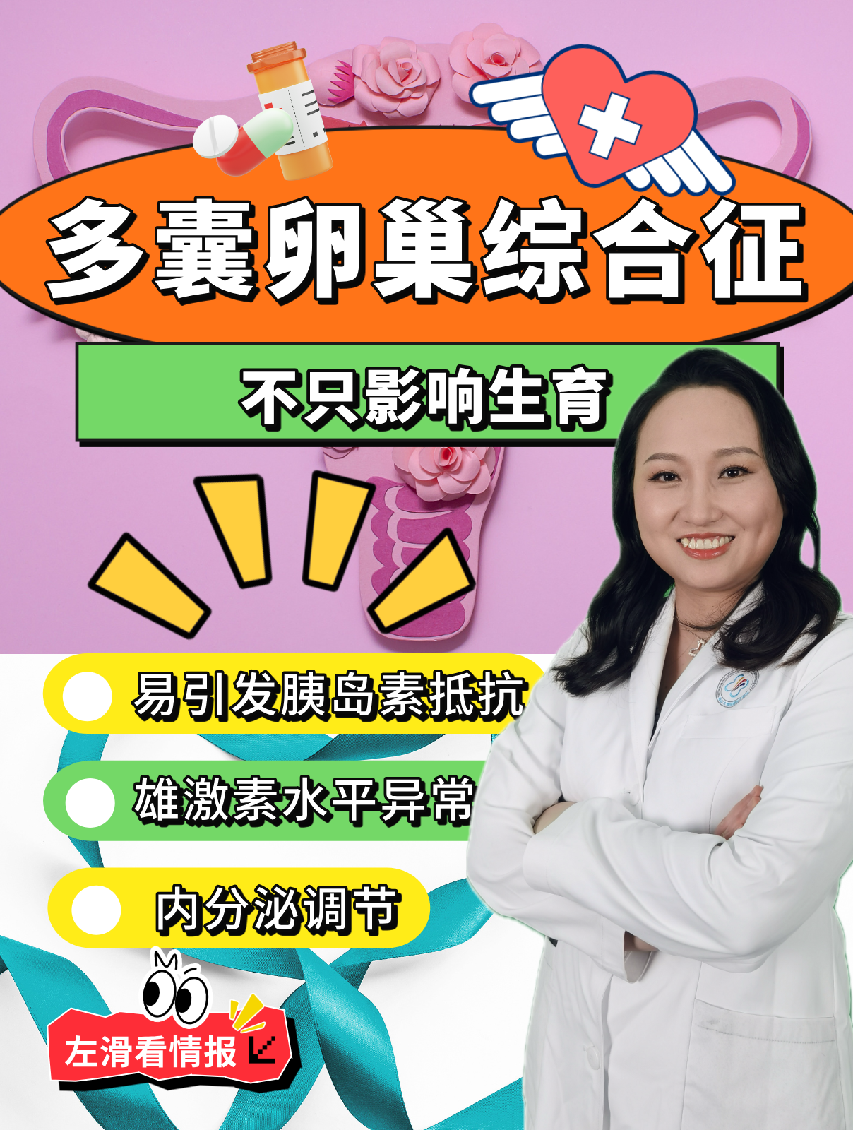 多卵巢多囊综合症治疗