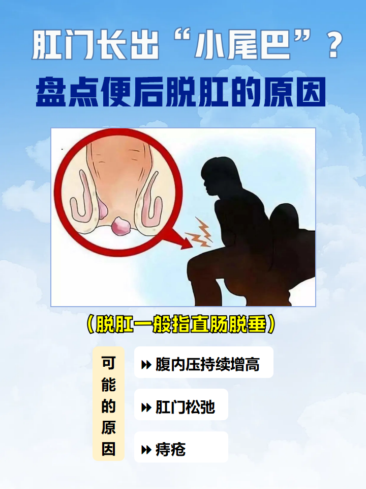 一般在患者排便时,肛门可有肿块脱出,就像是肛门处长了一个"小尾巴"