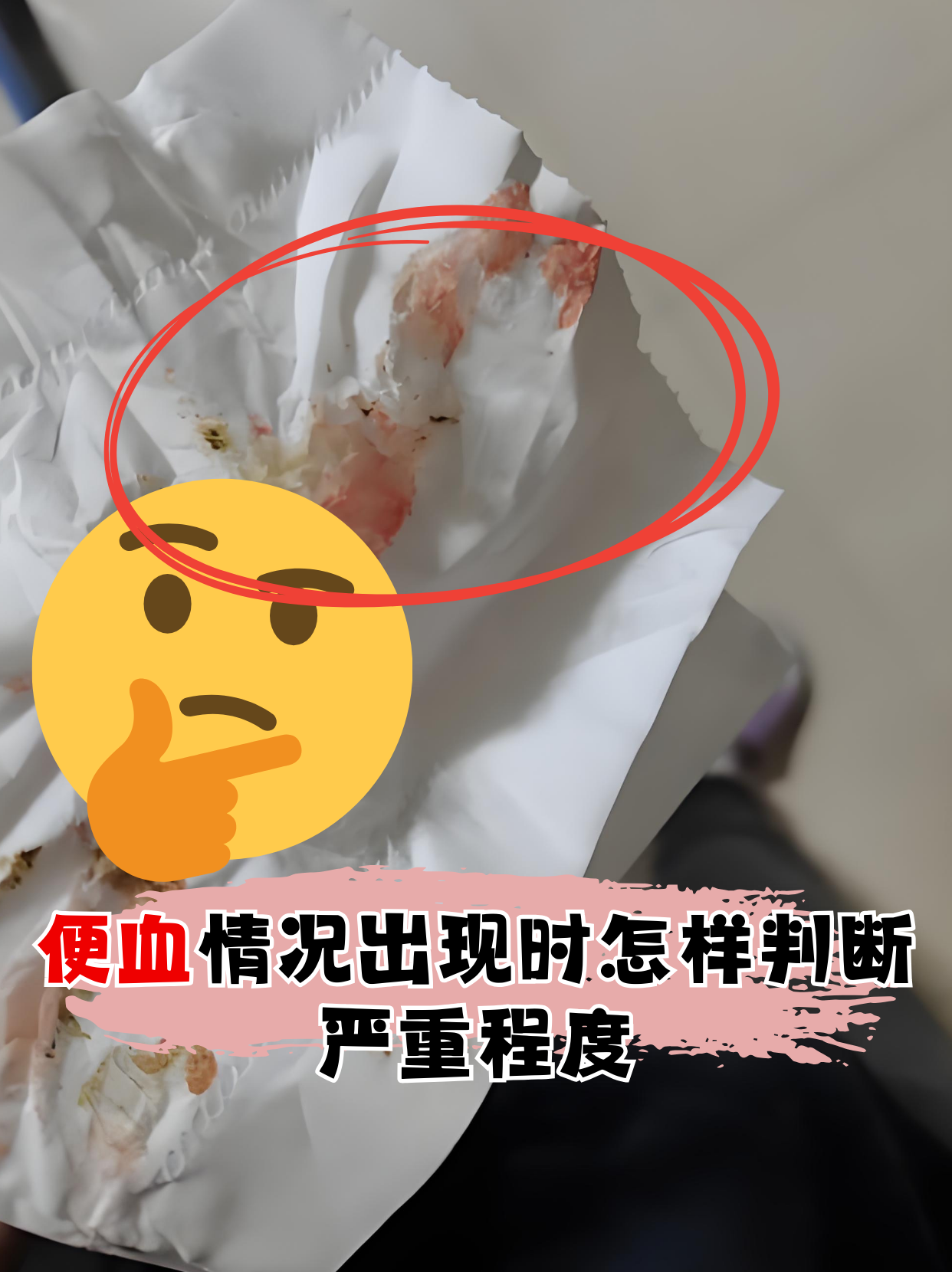 便血情况出现时怎样判断严重程度