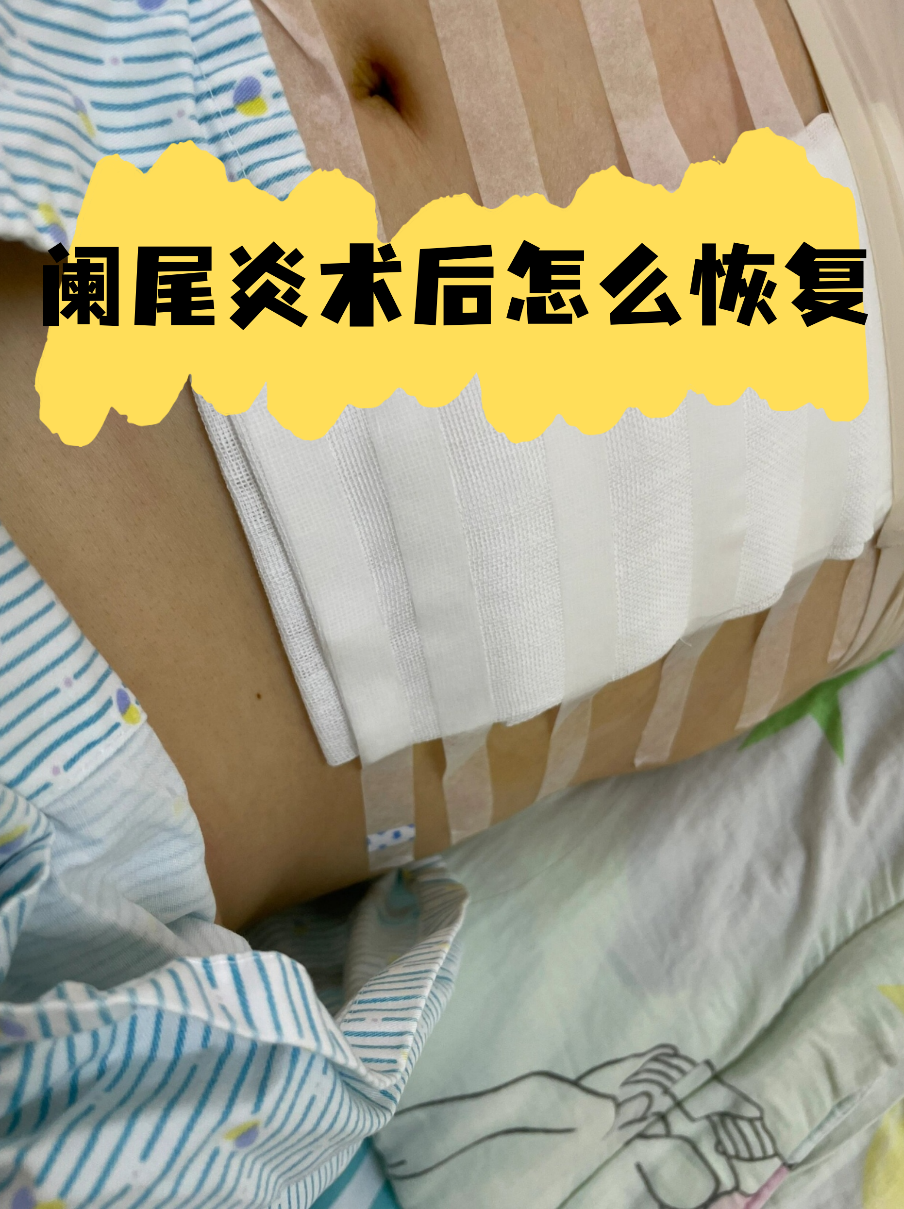 关于原火箭军总医院预约挂号陪诊一体出院居家护理提醒，科学恢复身体的信息