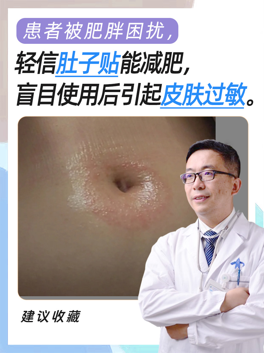揭秘肚子贴真的可以祛湿减肥吗?