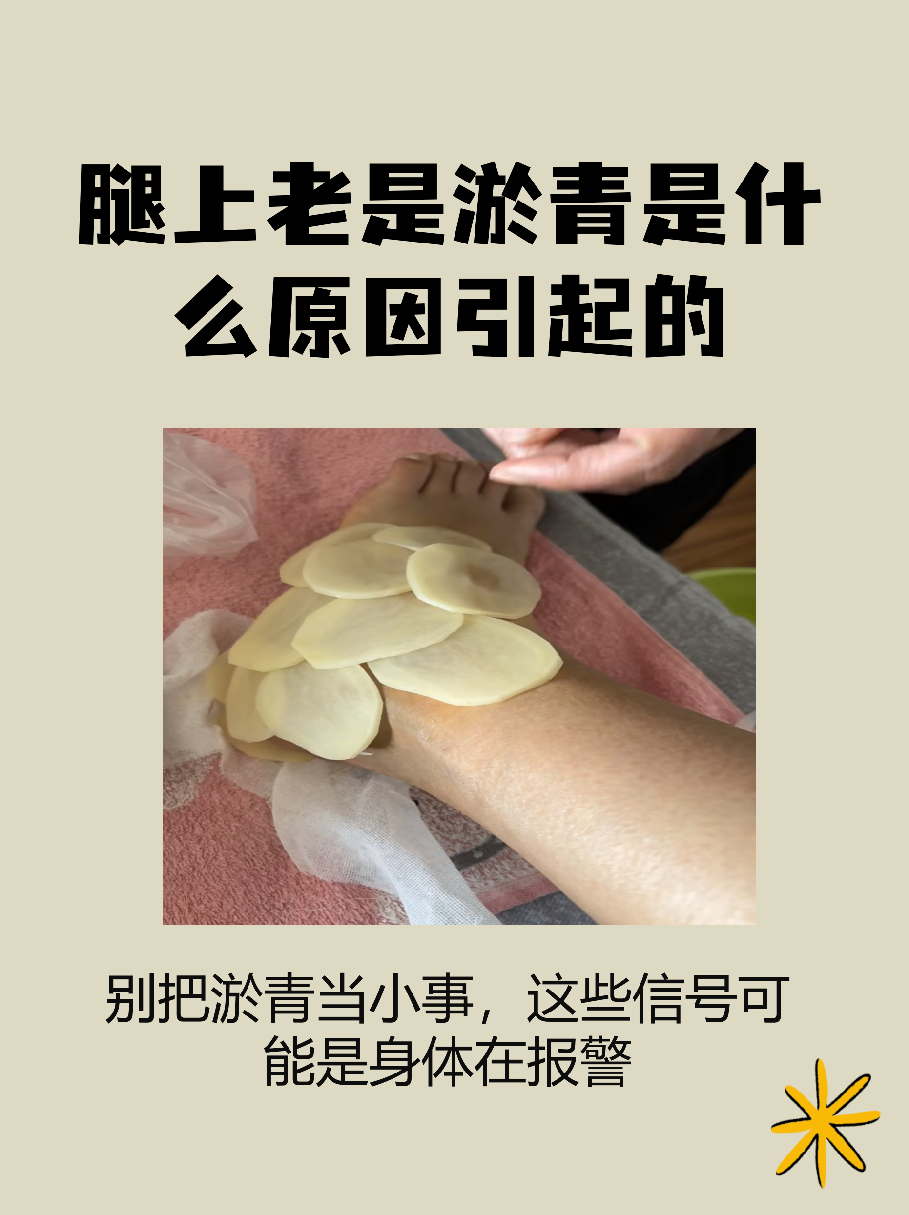 腿上老是淤青是什么原因引起的