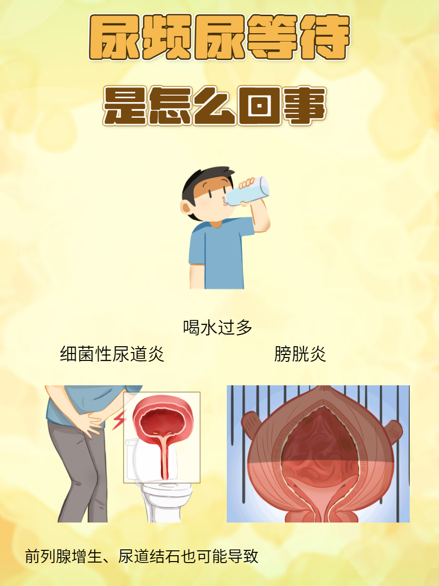 关于女性尿频尿多是什么原因的信息 关于女性尿频尿多是什么缘故起因

的信息（关于女性尿频尿多是什么缘故起因的信息有哪些） 女性