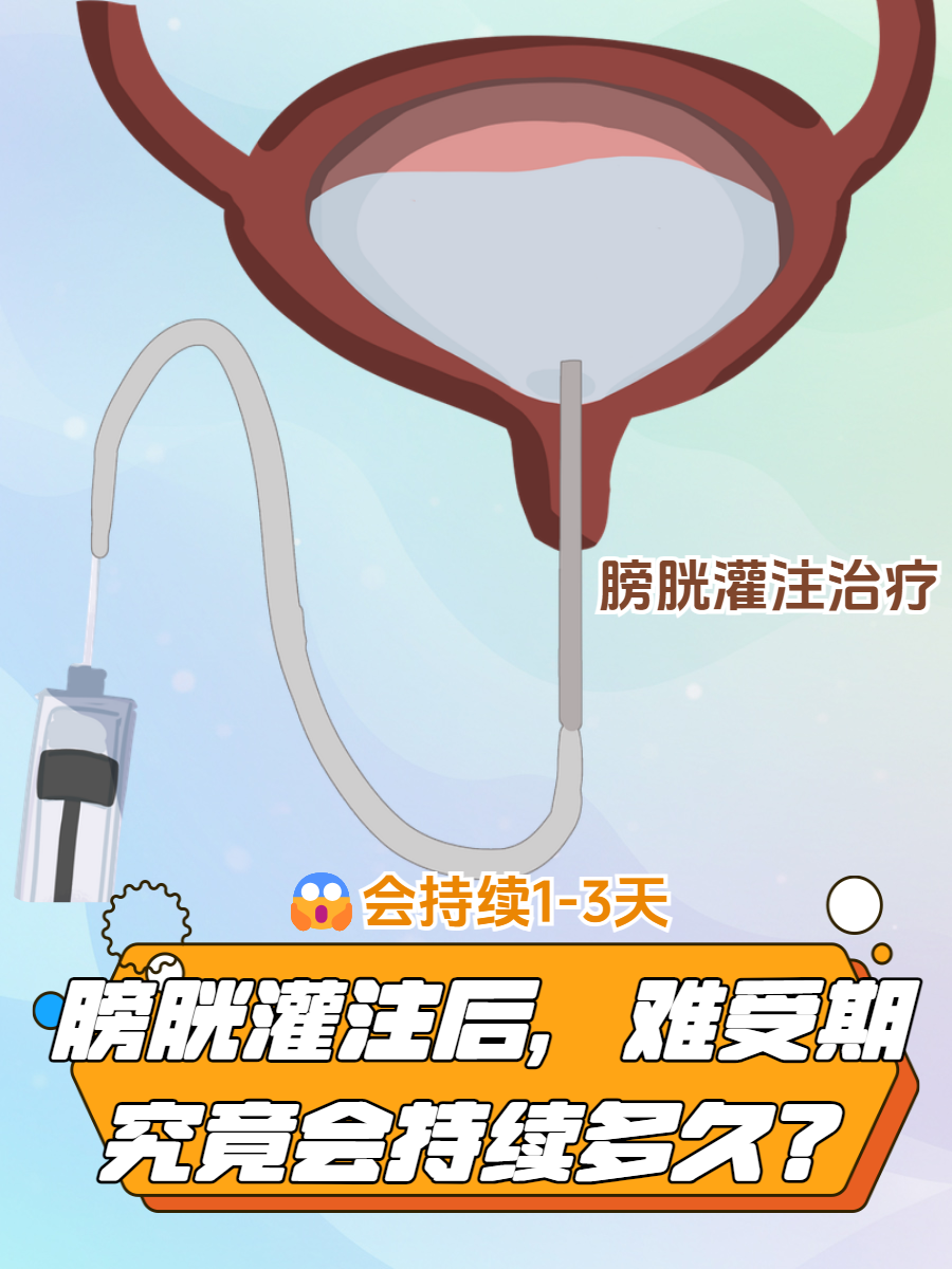膀胱灌注作为一种常见的治疗手段,在应对某些泌尿系统疾病时发挥着
