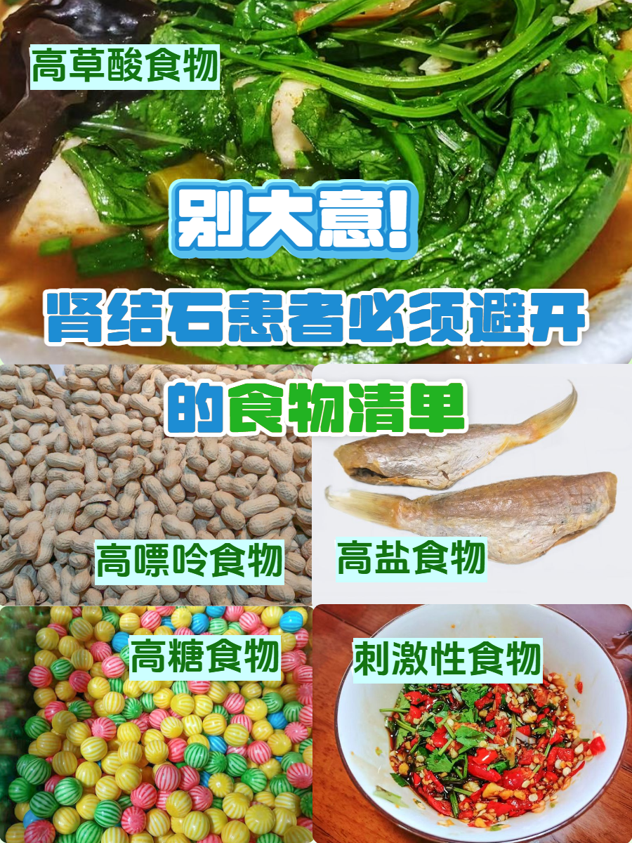 肾结石患者必须避开的食物清单
