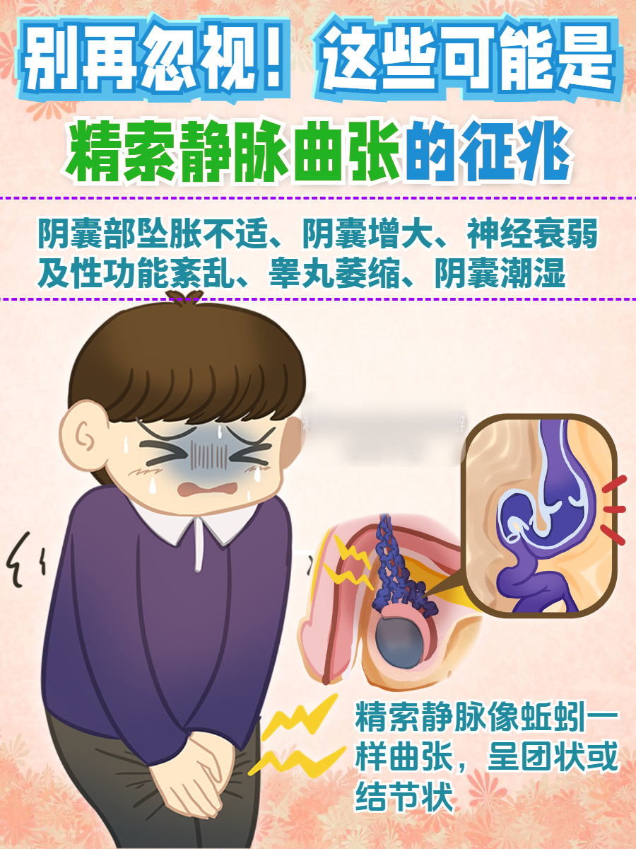 这些可能是精索静脉曲张的征兆