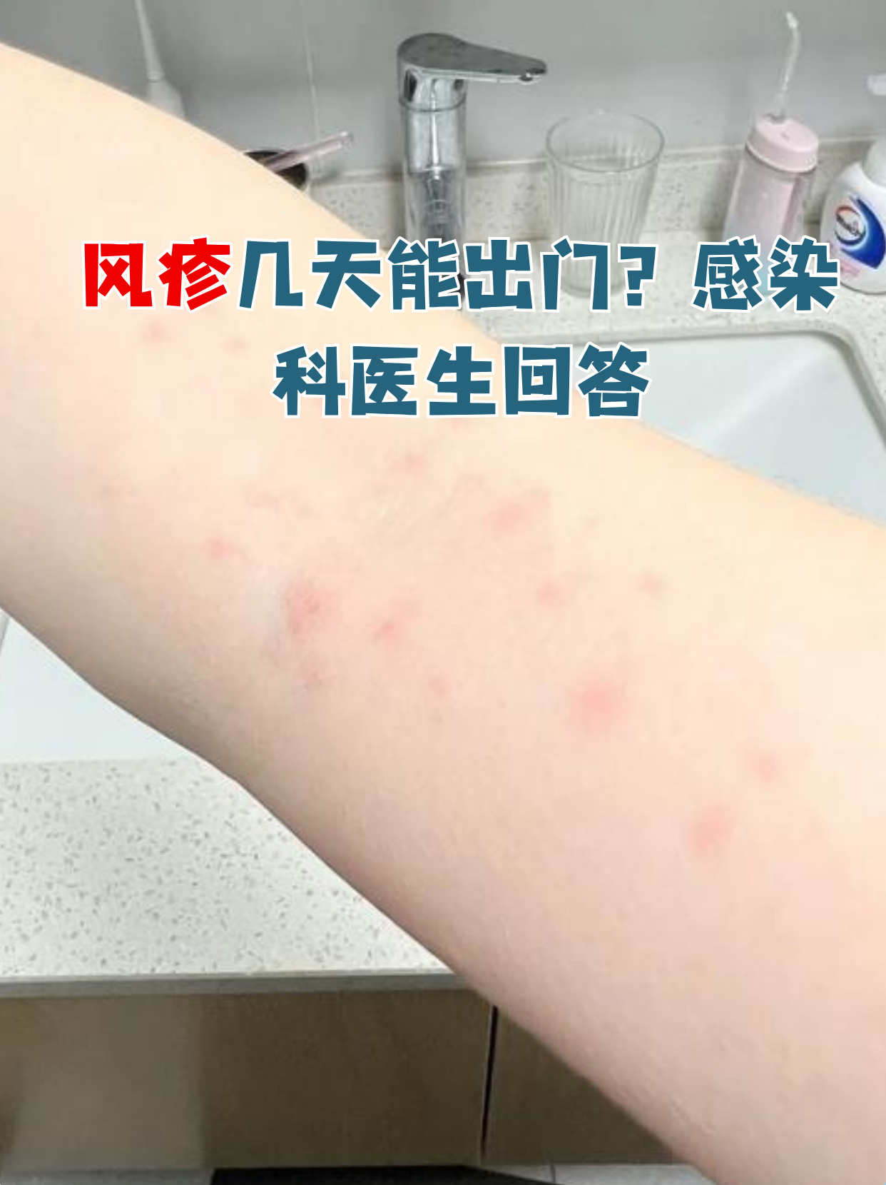 风疹几天能出门?