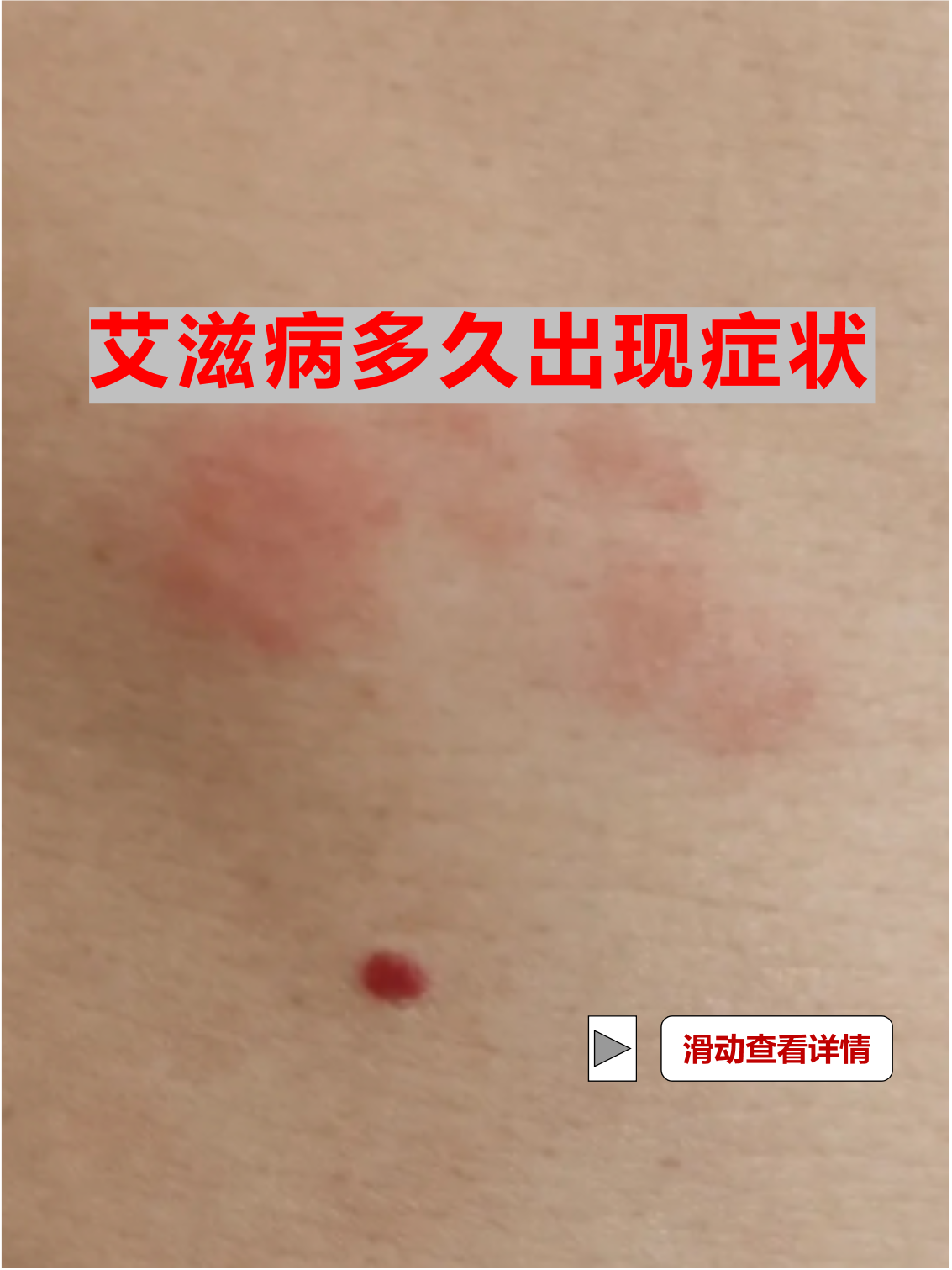  最近病毒感染有什么症状(最近病毒感染有什么症状表现吗)