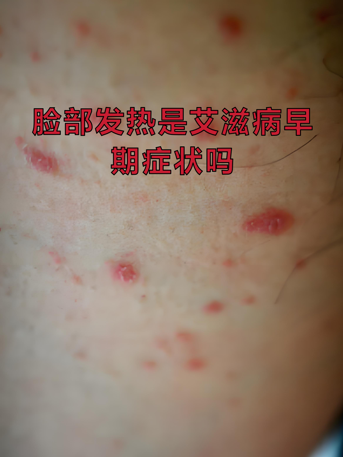  最近病毒的情况有哪些症状呢(常见疾病预防ppt)