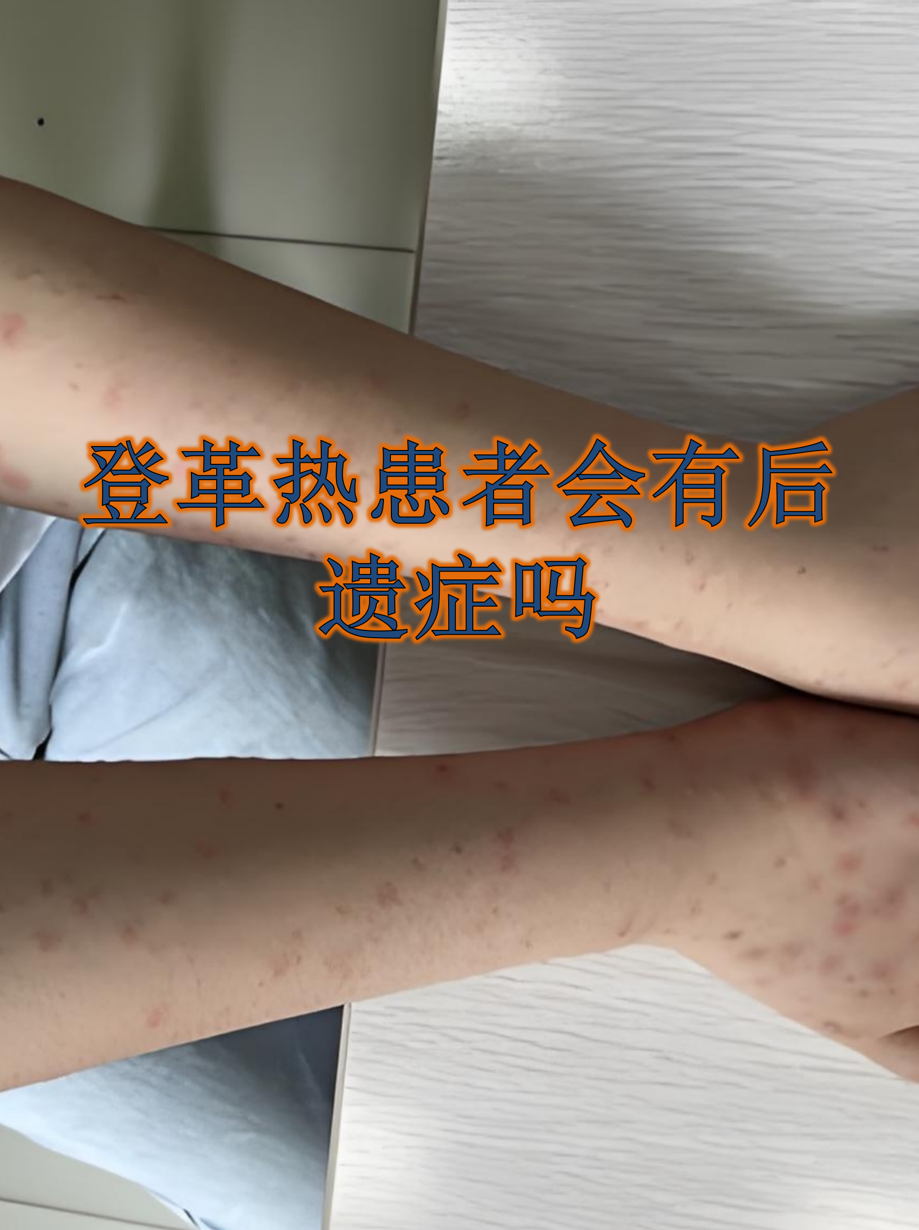 疫情后遗症有哪些症状图片大全集女性的简单介绍