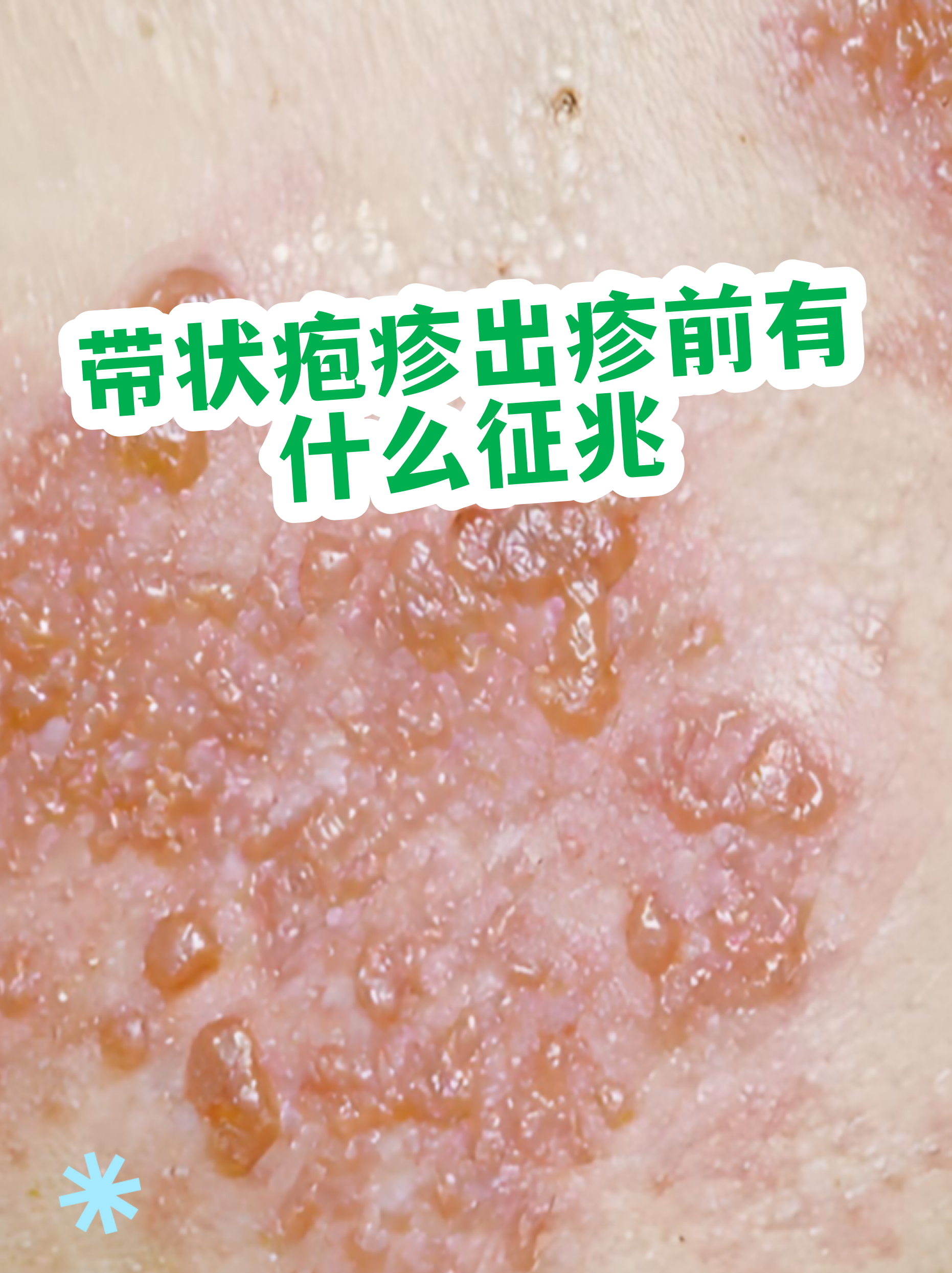  最近出来的病毒有哪些症状表现(现在这个病毒有什么症状)