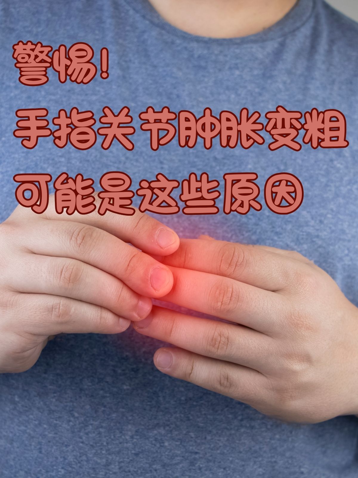 手指关节肿胀变粗可能是这些原因 手指关节肿胀变粗,不仅影响手部美观