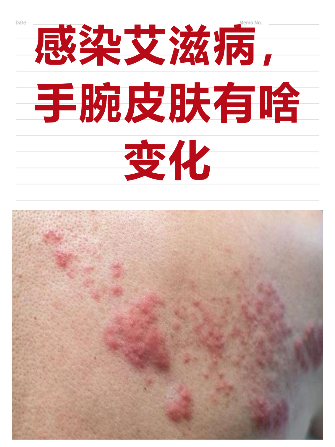  最近病毒的症状是什么样的(最近病毒的症状是什么样的表现)