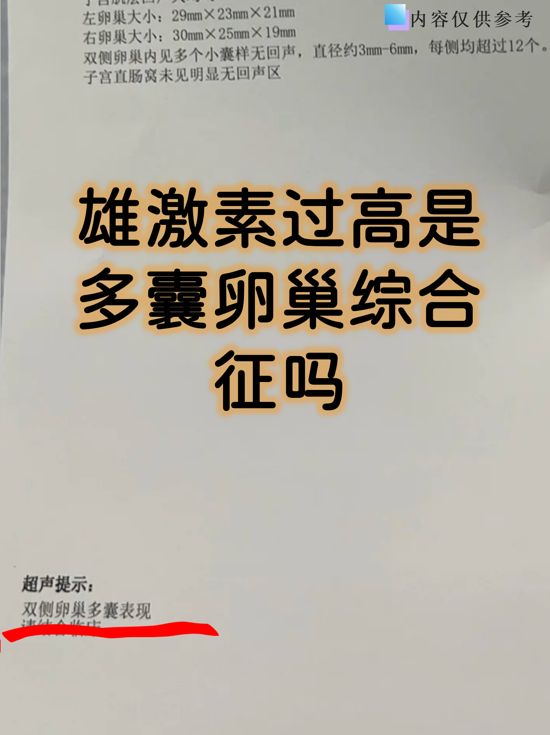 雄激素过高是多囊卵巢综合征吗