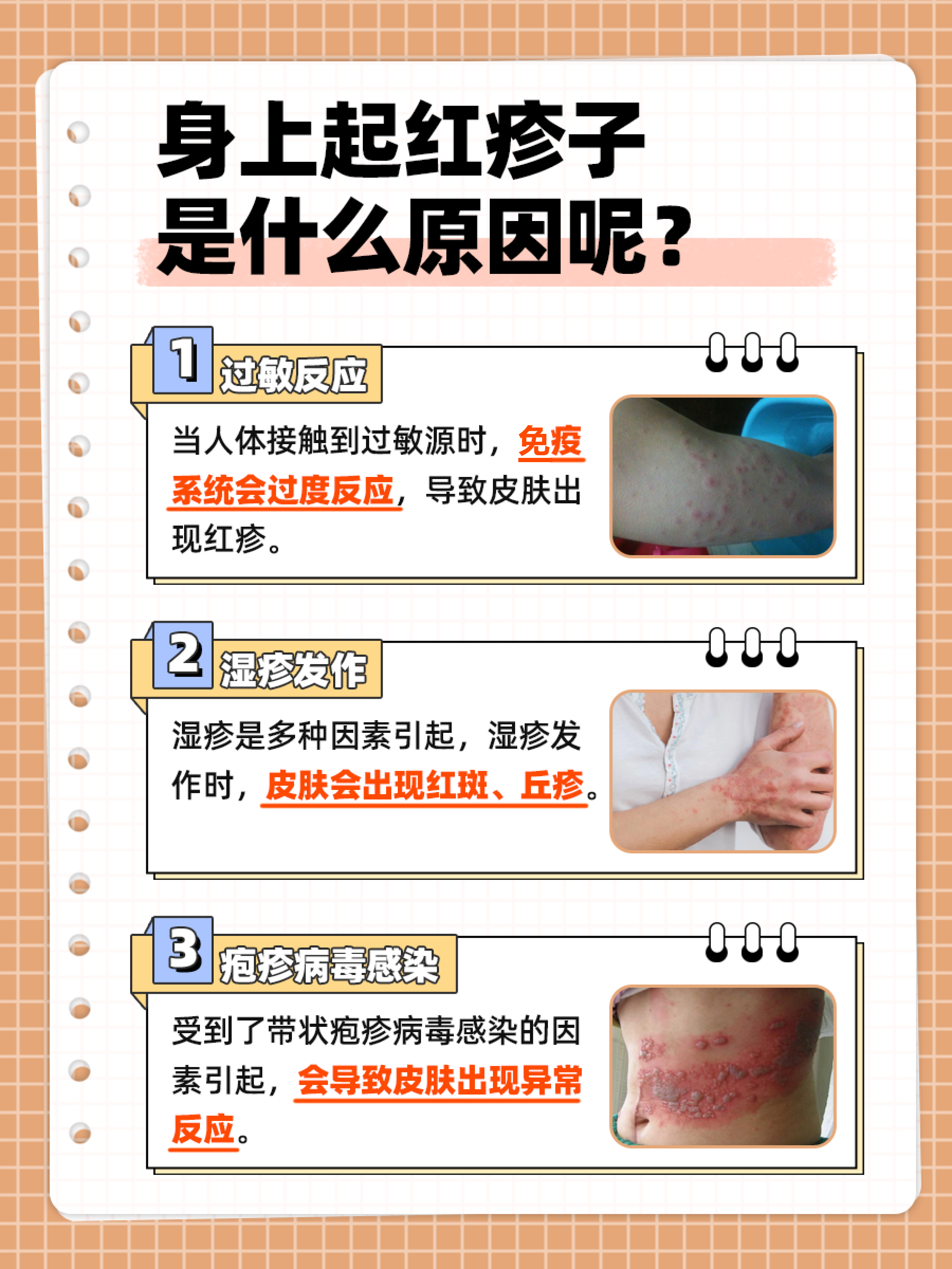 了解红疹的成因,采取适当的护理措施,对于缓解红疹症状,促进皮肤恢复