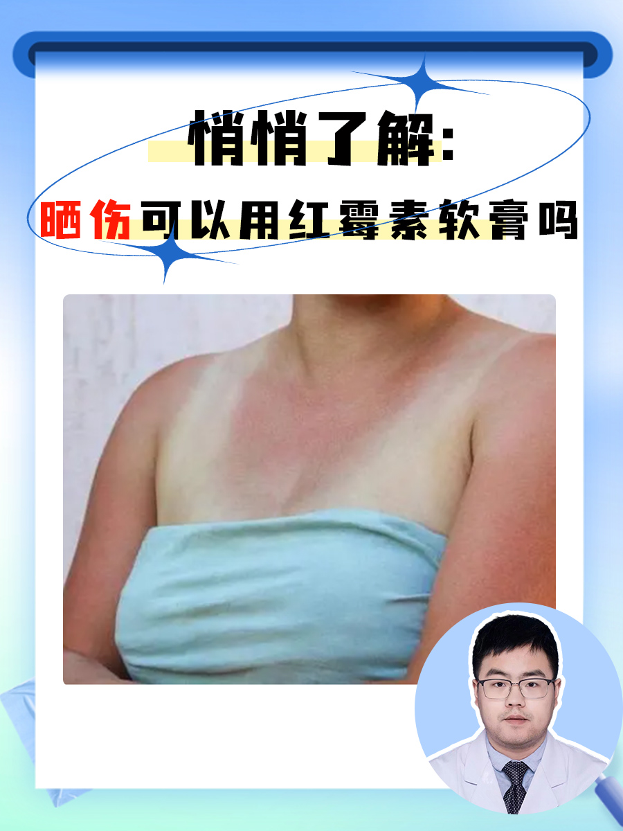 晒伤是长时间的紫外线照射引起了皮肤当中的水分流失,并且伴有皮肤