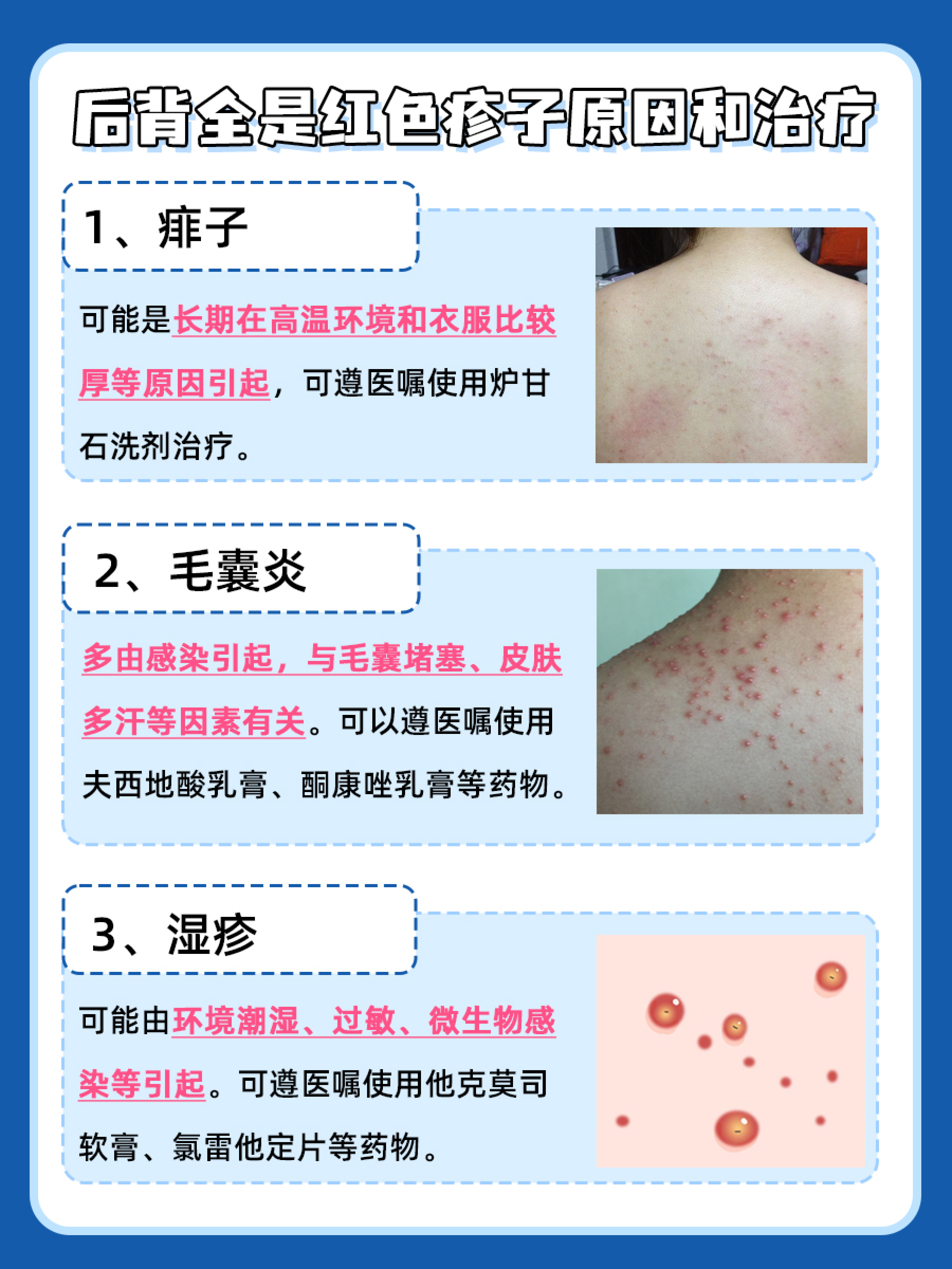 背后全是红色疹子:快来了解原因  红疹子在医学上也被称为皮疹和红疹