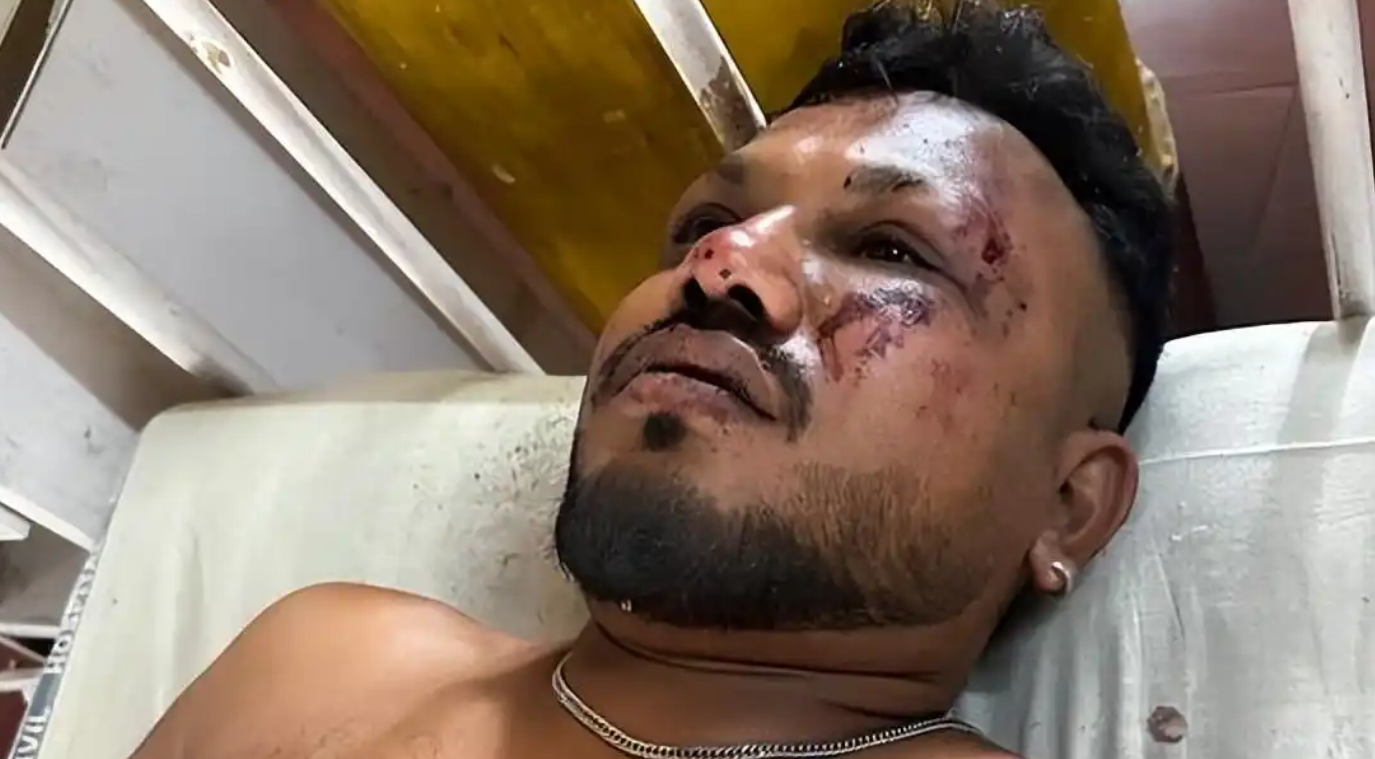 今天早上看到一条新闻,说印度一架飞机出事了,飞机上载有242人,目前