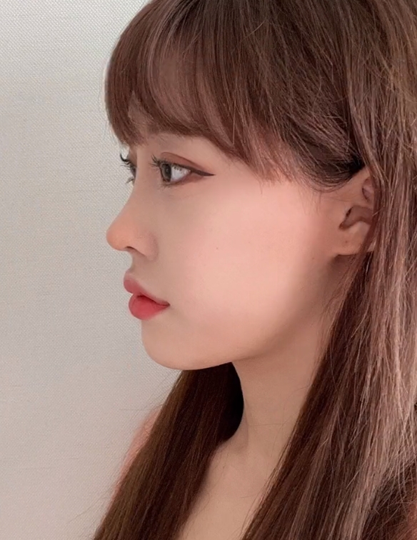 鼻基底的高度,主要是指鼻翼下方底部与鼻小柱相同方向上(即前后方向上