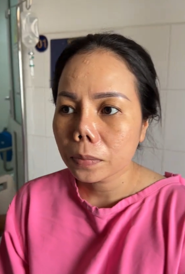 谁能想到我做个隆鼻,最后竟把自己搞成 "猪鼻子"?