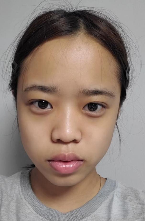 没有鼻尖的鼻子图片大鼻头什么样长鼻子明显大头鼻子图片鼻梁以下素颜