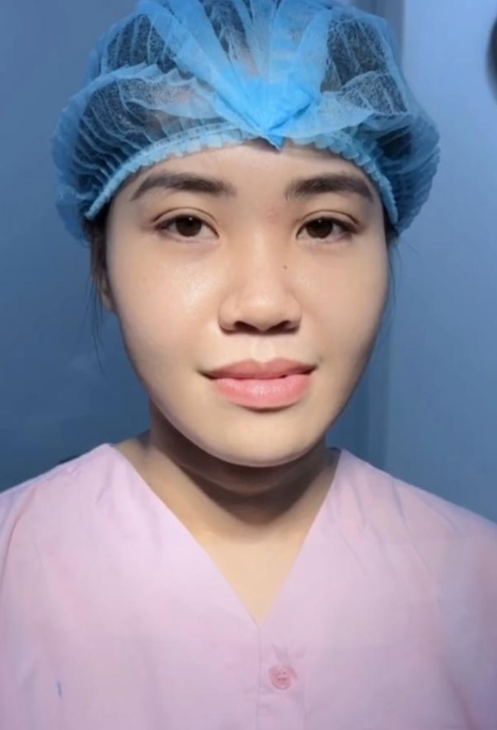 姑娘属于大鼻头,鼻梁比较低矮,鼻根部宽,正面看鼻头鼻翼宽大,鼻翼比较