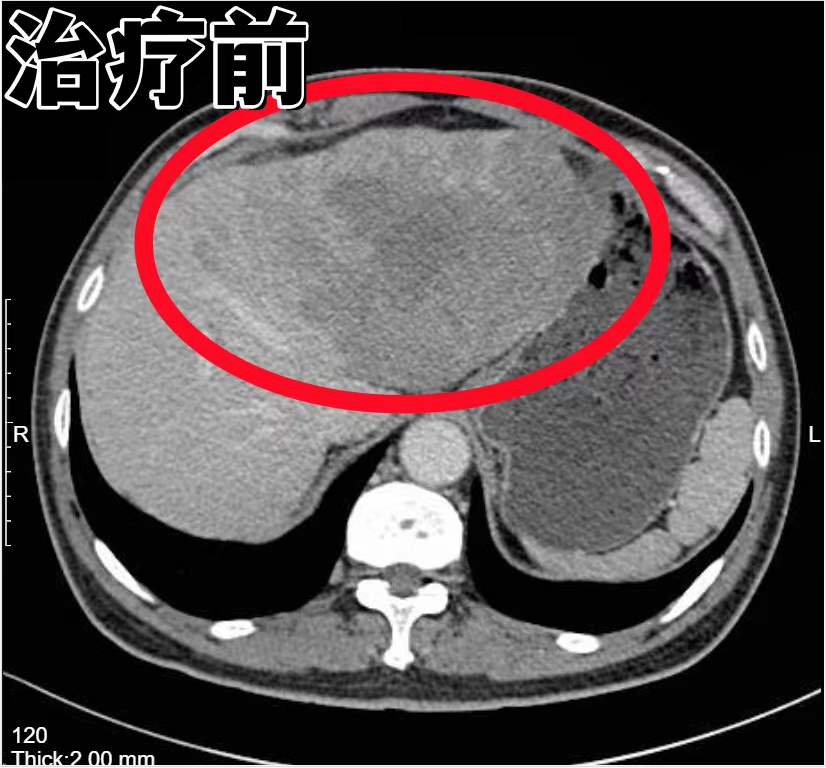 包含中国医学科学院肿瘤医院、昌平区号贩子电话,推荐这个跑腿很负责!的词条