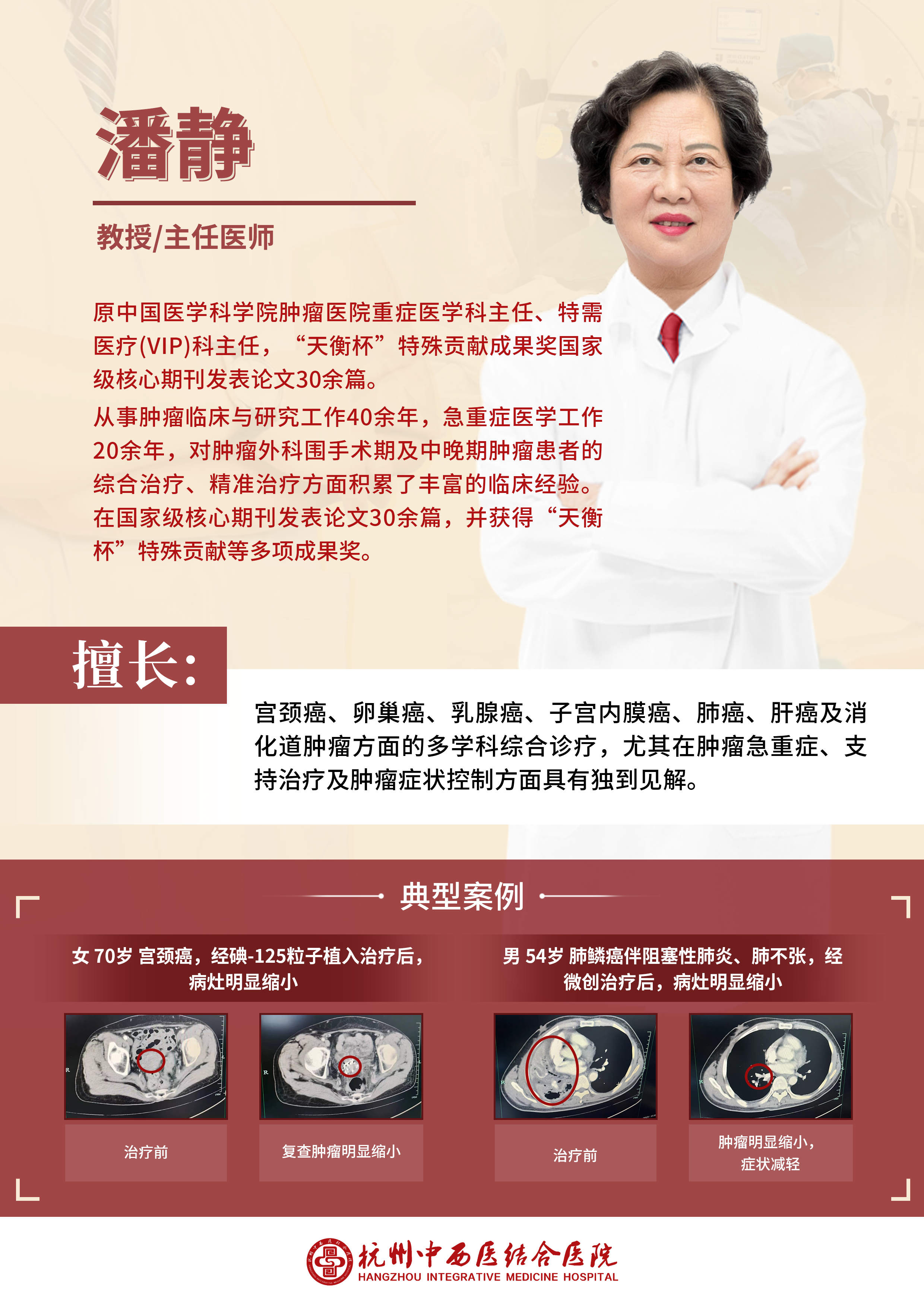 中国医学科学院肿瘤医院加微信咨询挂号