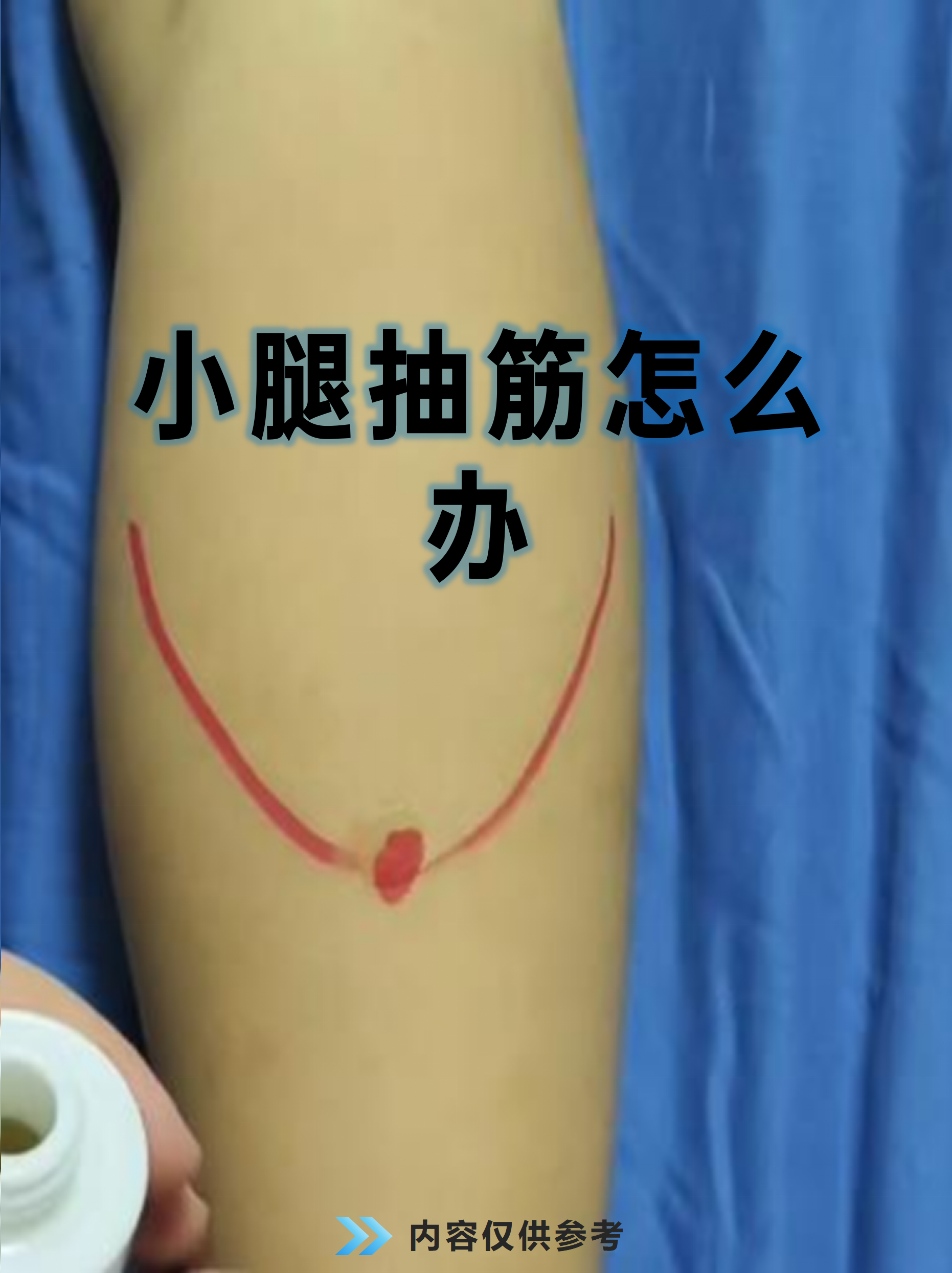 小腿抽筋是许多人半夜惊醒的"噩梦",那种肌肉突然