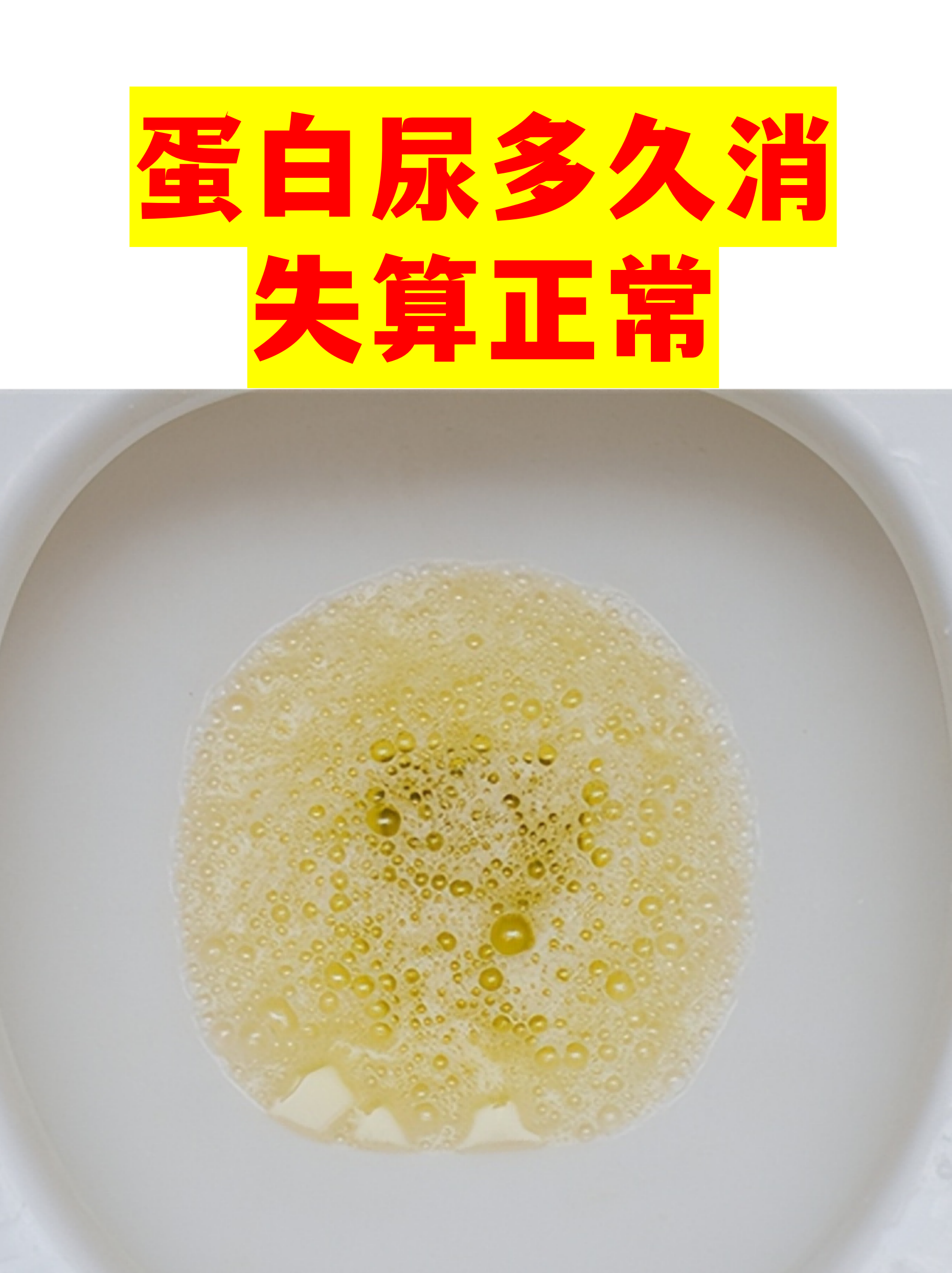 蛋白尿多久消失算正常