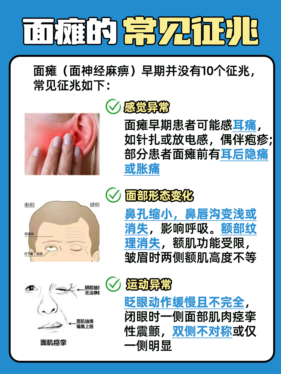 面瘫后,脸部表情变得僵硬